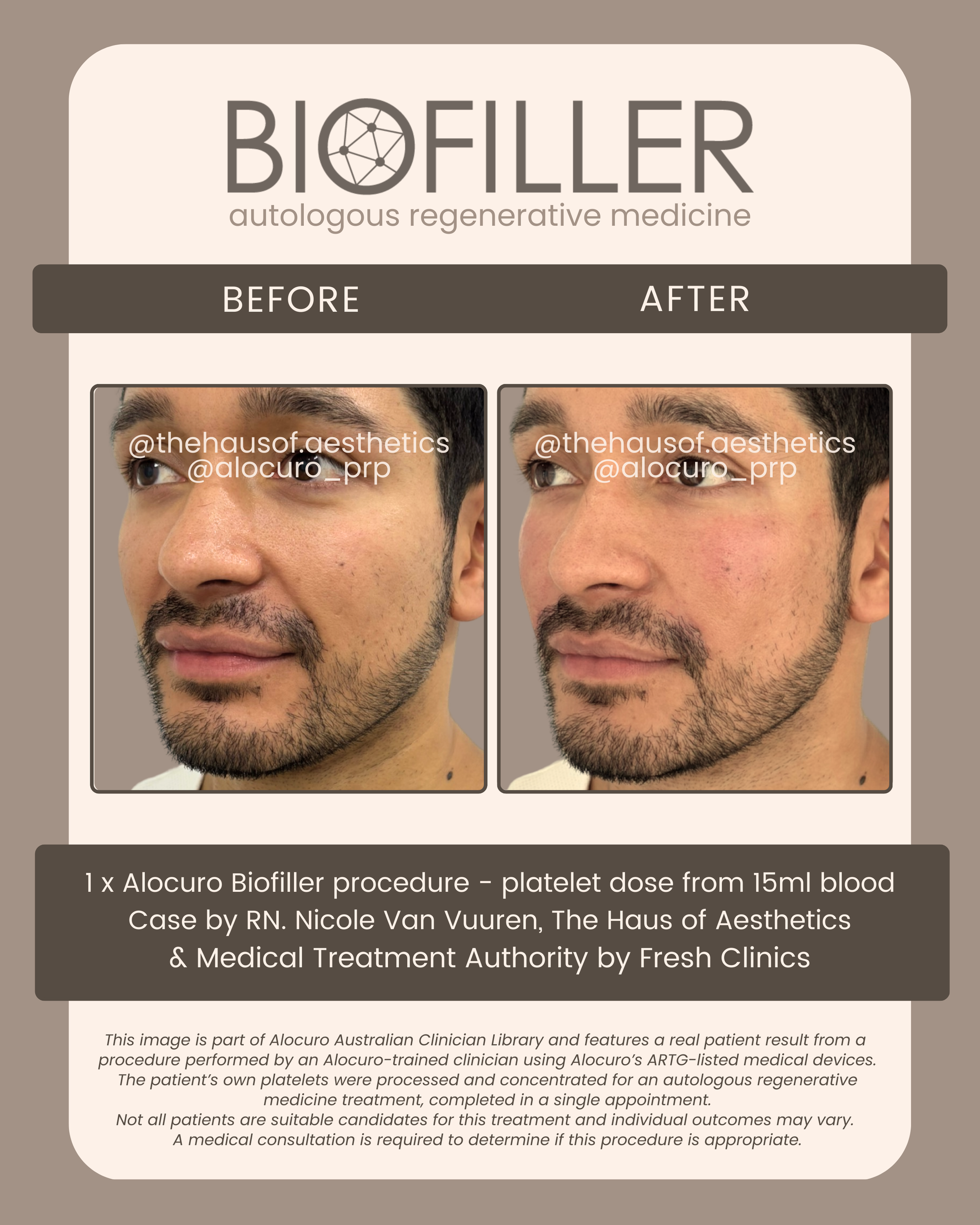 Final Biofiller - B&A - THoA 2025 A.png