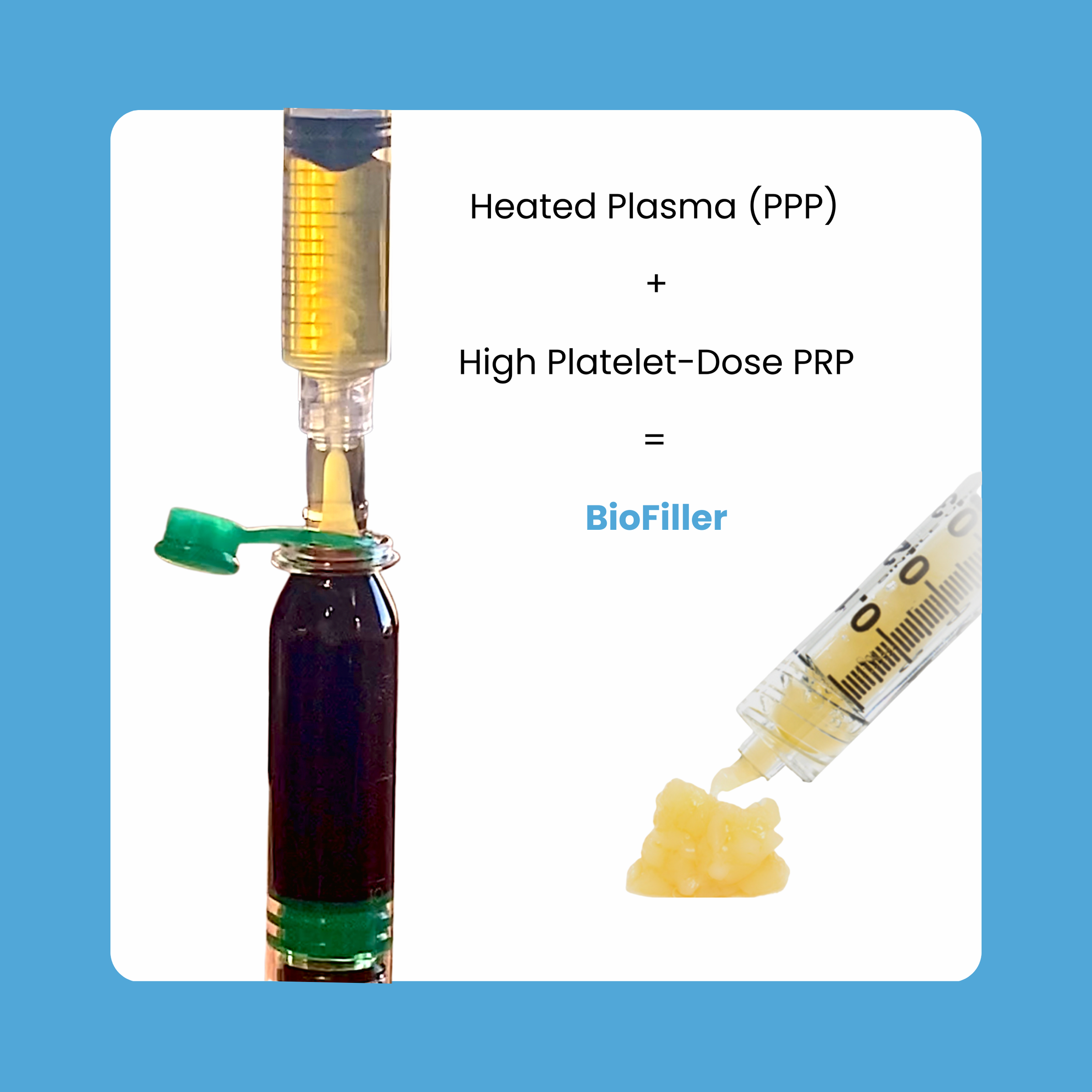 The Science Behind Biofiller - Platelets, Growth Factors, and Regeneration