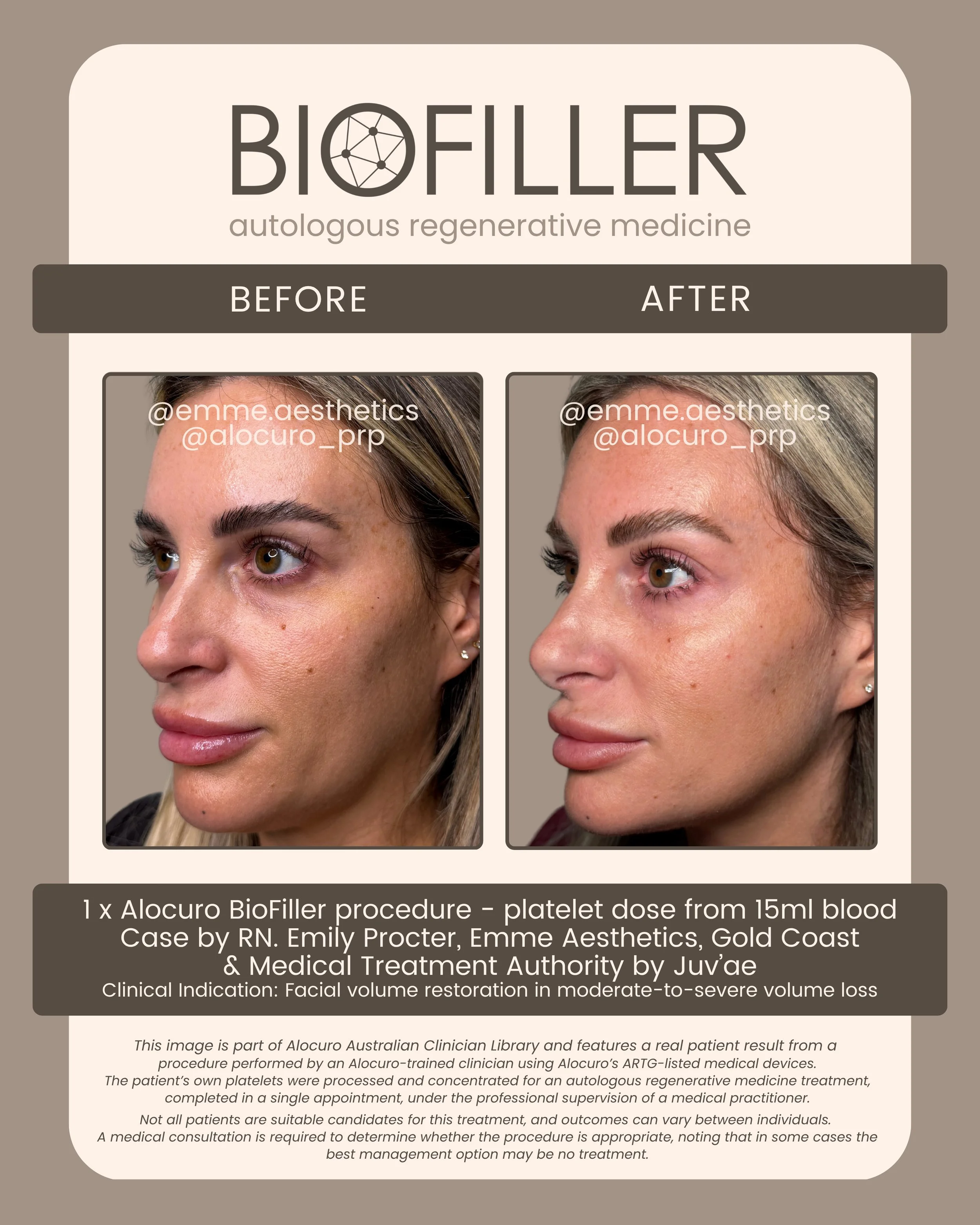 Sept 2026 Biofiller - B&A - Emme B2.jpg