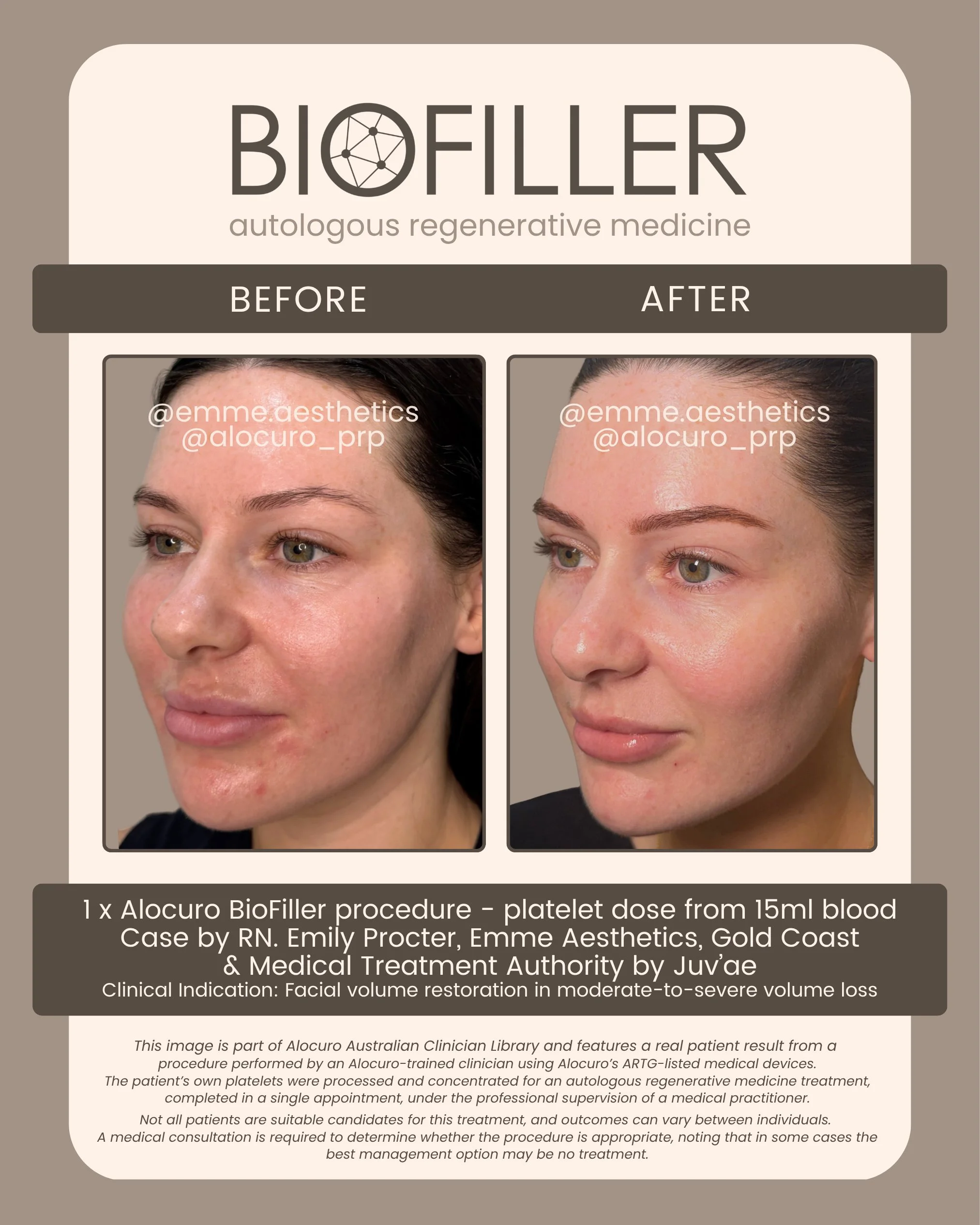 Sept 2026 Biofiller - B&A - Emme C2.jpg