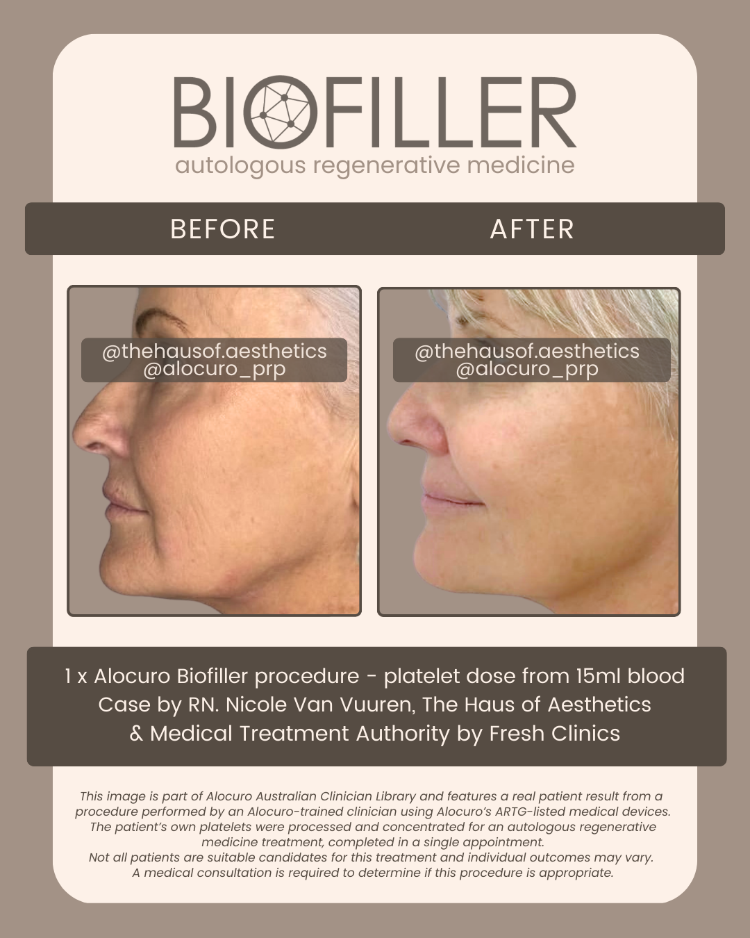 HP Final Biofiller - B&A - THoA 2025 D.png