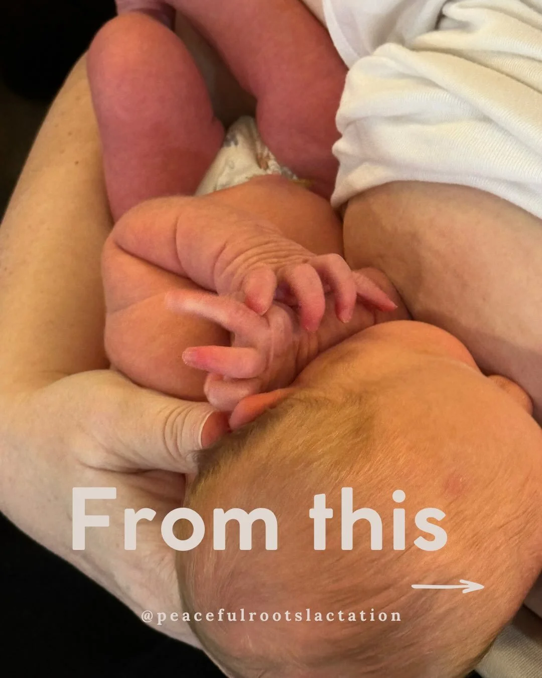 Sometimes a more comfortable, sustained latch can come from a few small positioning adjustments.

Here, improving alignment, closeness, and support helped baby stay latched and made feeding more comfortable for both mum and baby.

&bull; baby&rsquo;s