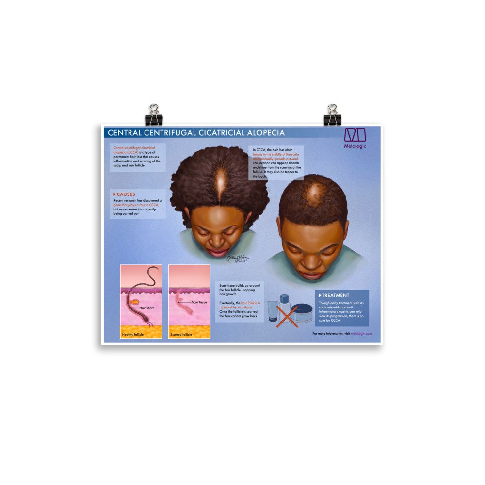 enhanced-matte-paper-poster-(in)-11x14-transparent-64c1b38e96197.jpg