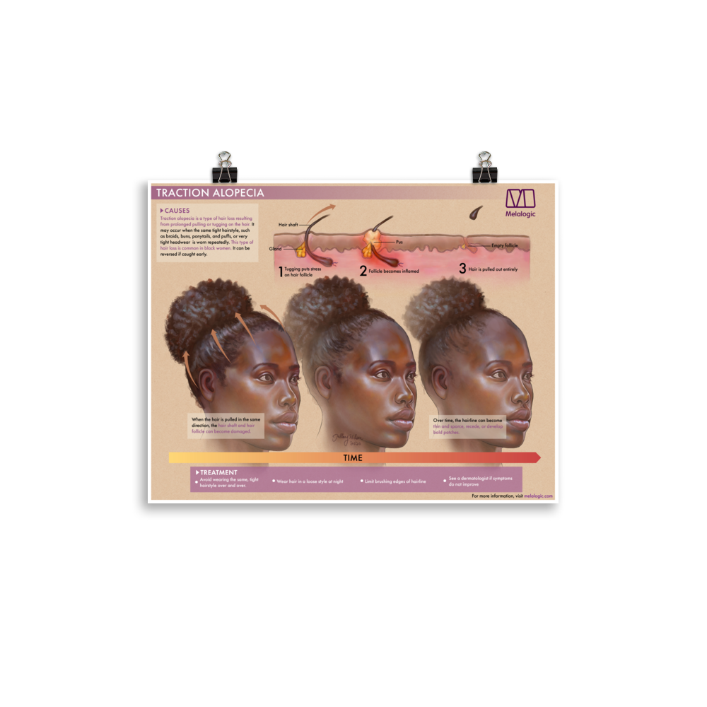 enhanced-matte-paper-poster-(in)-11x14-transparent-64c1bb736ef6b.png