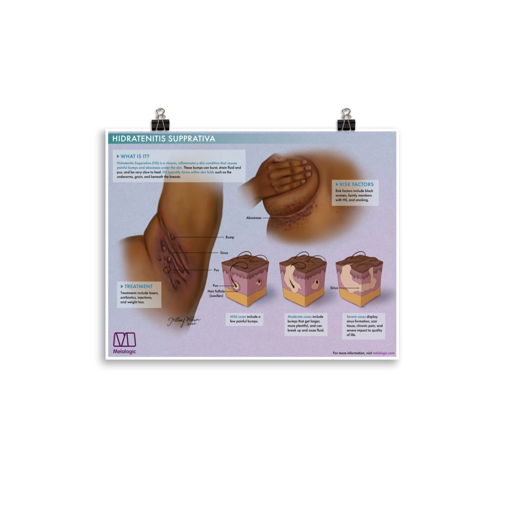 enhanced-matte-paper-poster-(in)-11x14-transparent-64c1bef553685.png