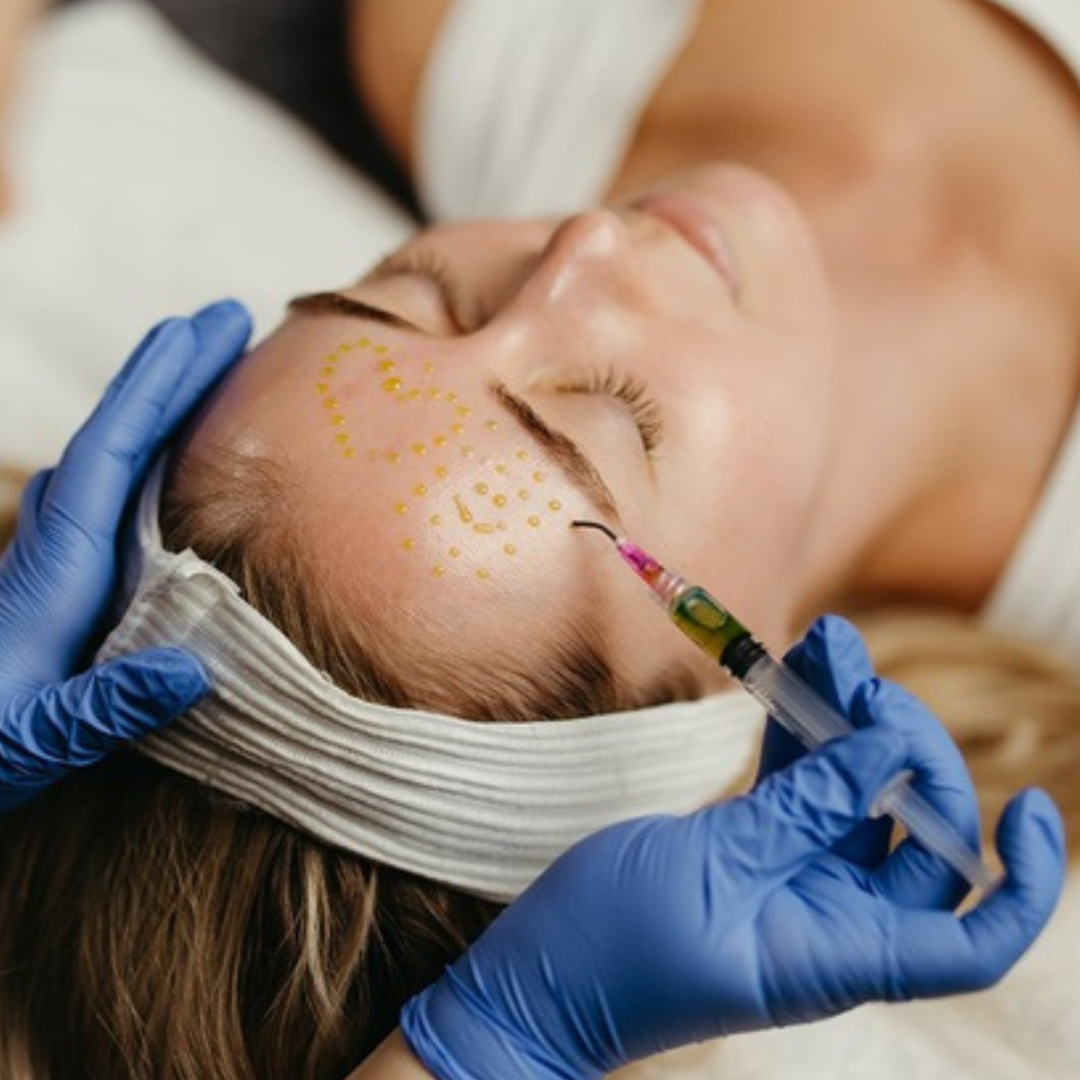 A person lying down receiving a chemical peel from a medical professional wearing blue gloves, with yellow heart-shaped markings on the person's forehead.