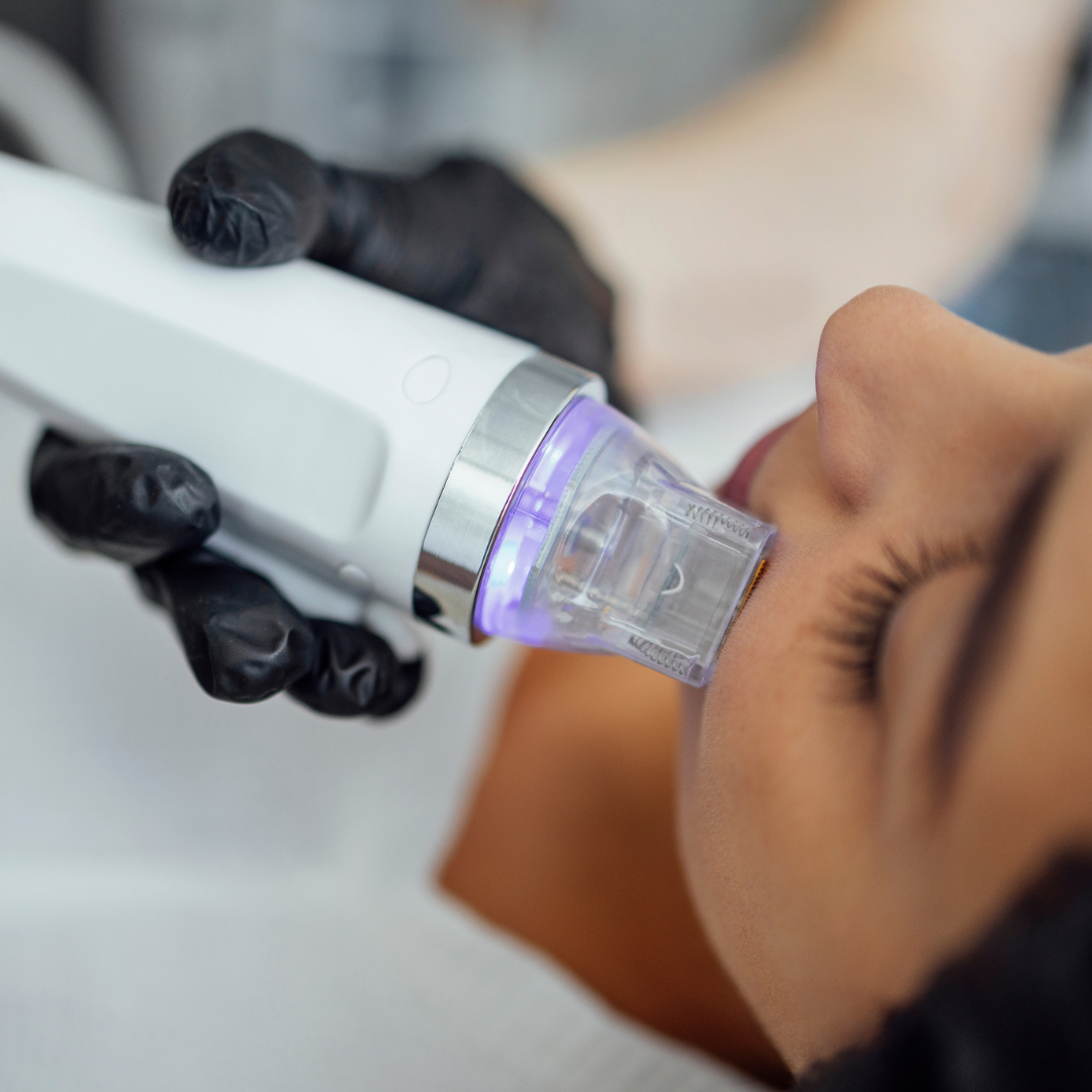 A person receiving a facial treatment or skincare procedure with a handheld device emitting purple light, while lying down.