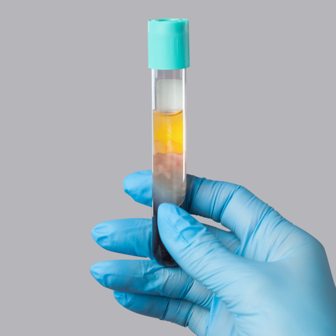 Close-up of a gloved hand holding a test tube with blood sample against a plain gray background.