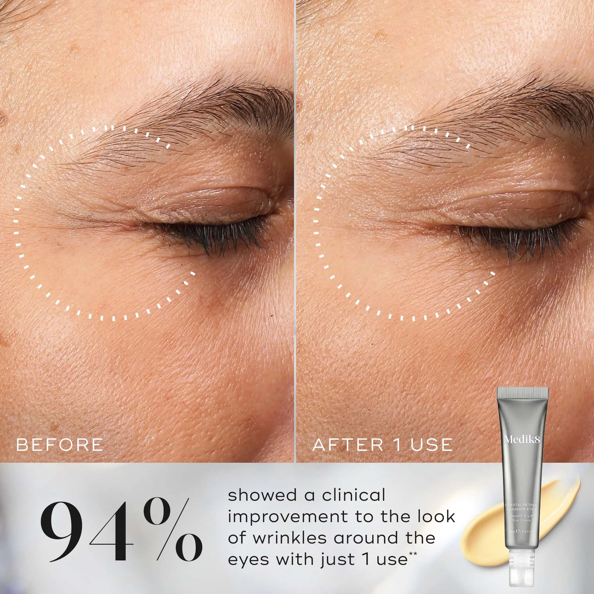 Crystal Retinal Ceramide Eye 3 3.jpg