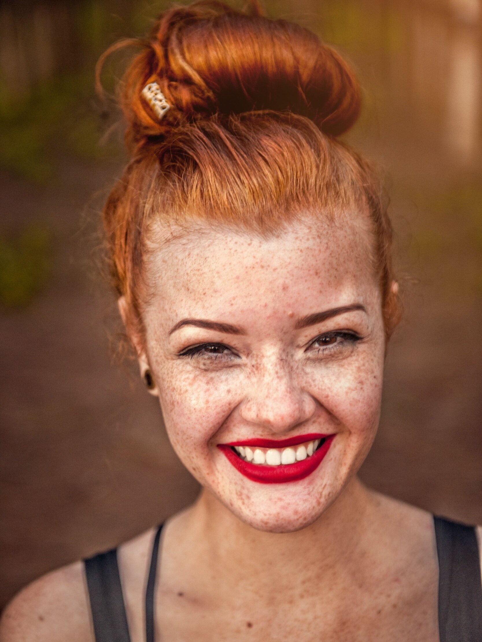 What is photosensitivity?