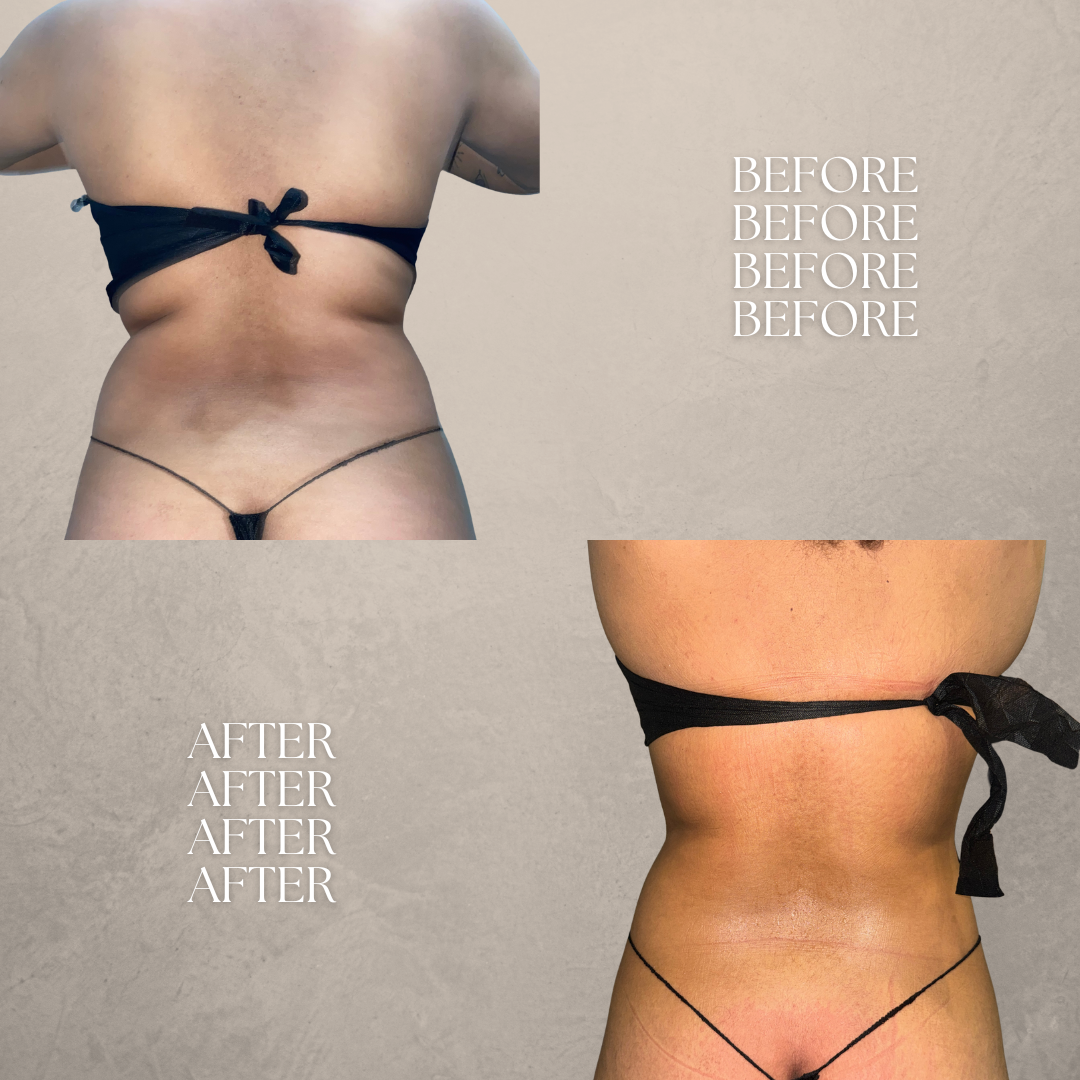 BEFORE AND AFTERS (3).png