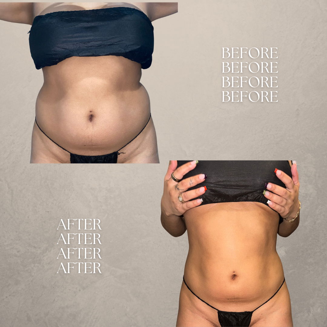 BEFORE AND AFTERS (2).png