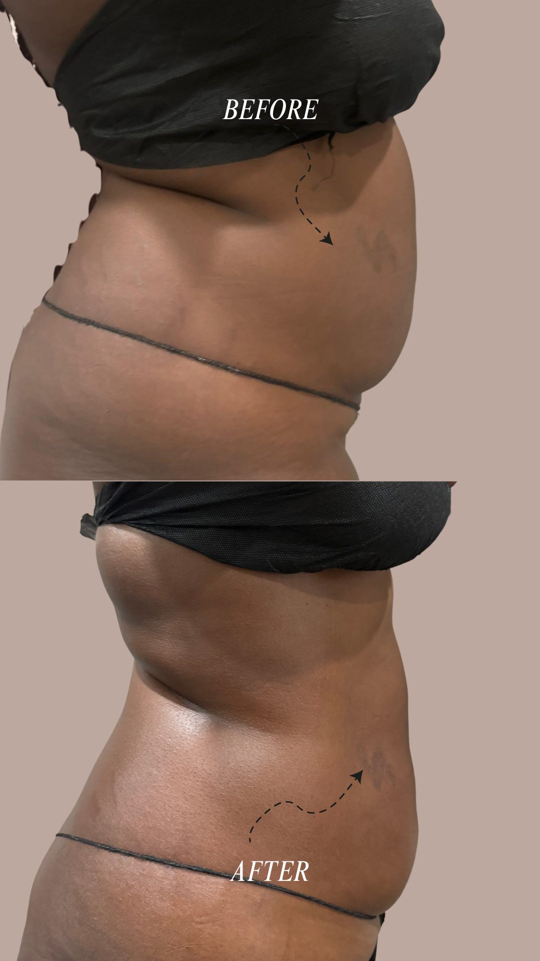 before and after story-2.png