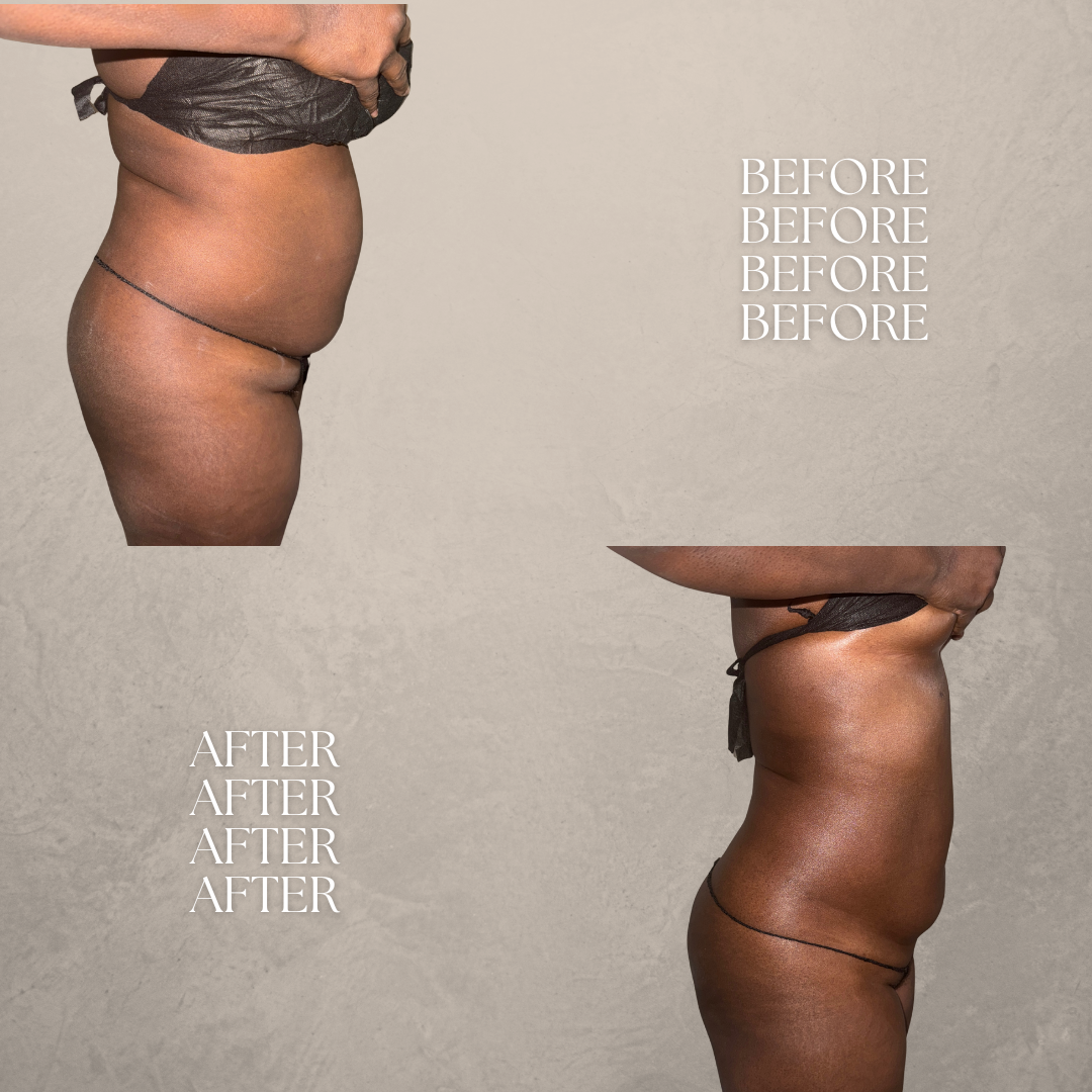 BEFORE AND AFTERS.png