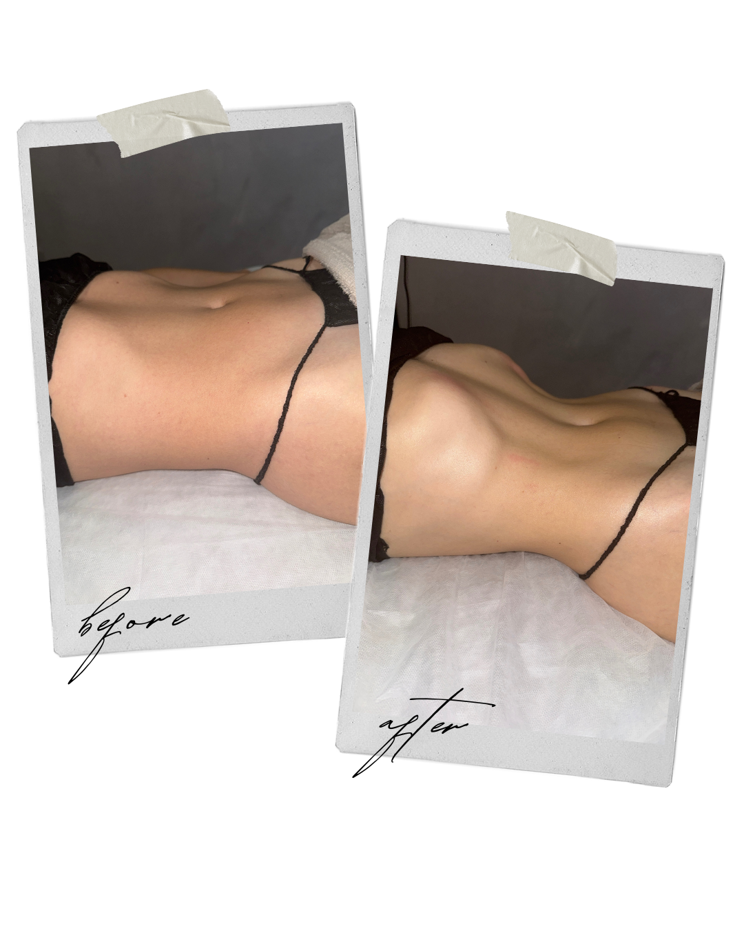 After One The Full Body Sculpt+Drain Session