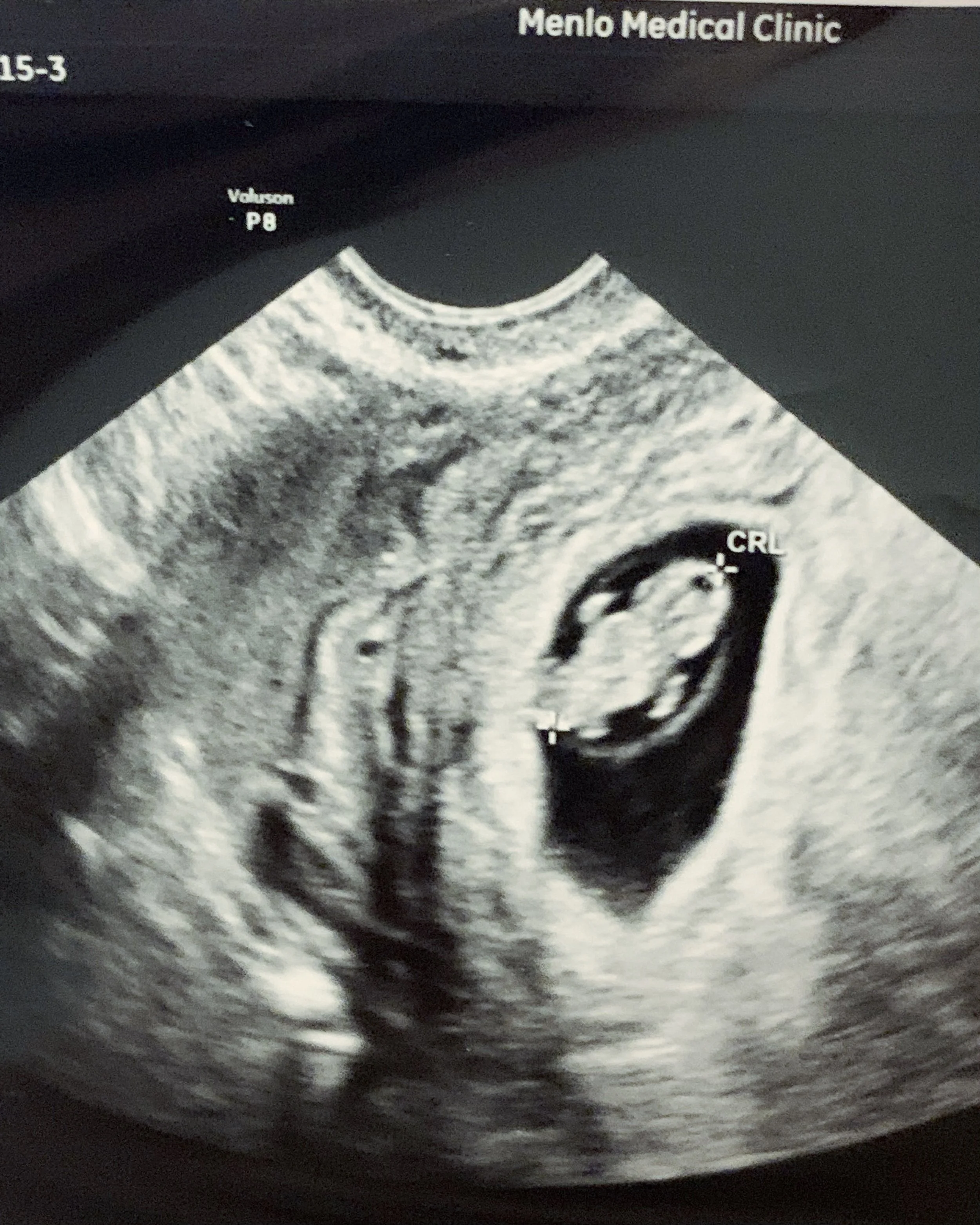 Ultrasound of a current patient at Northwestern Children's Practice