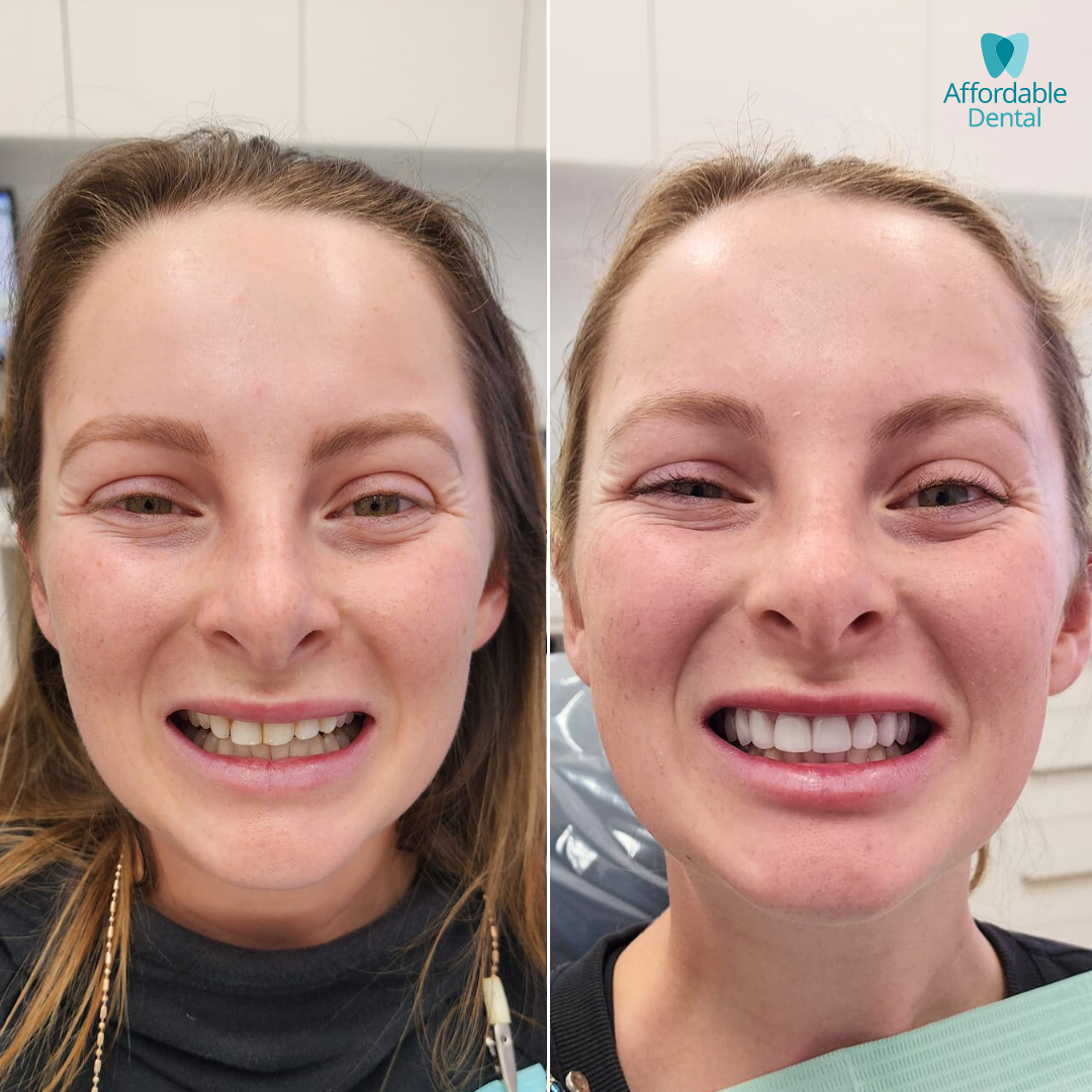 Affordable Dental Before & After Updated (5).png