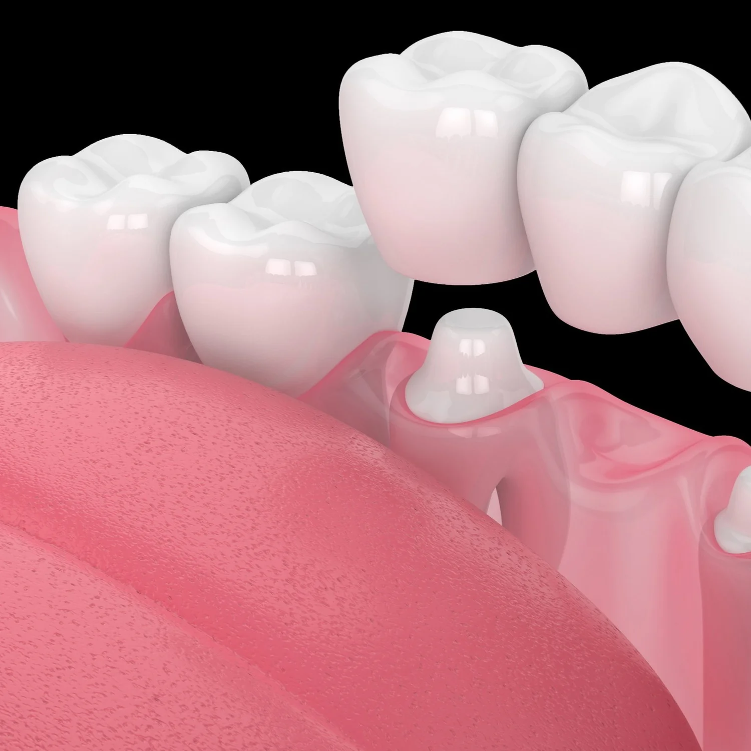 Dental & Denture Clinics Affordable Dentures & Implants Affordable Dental