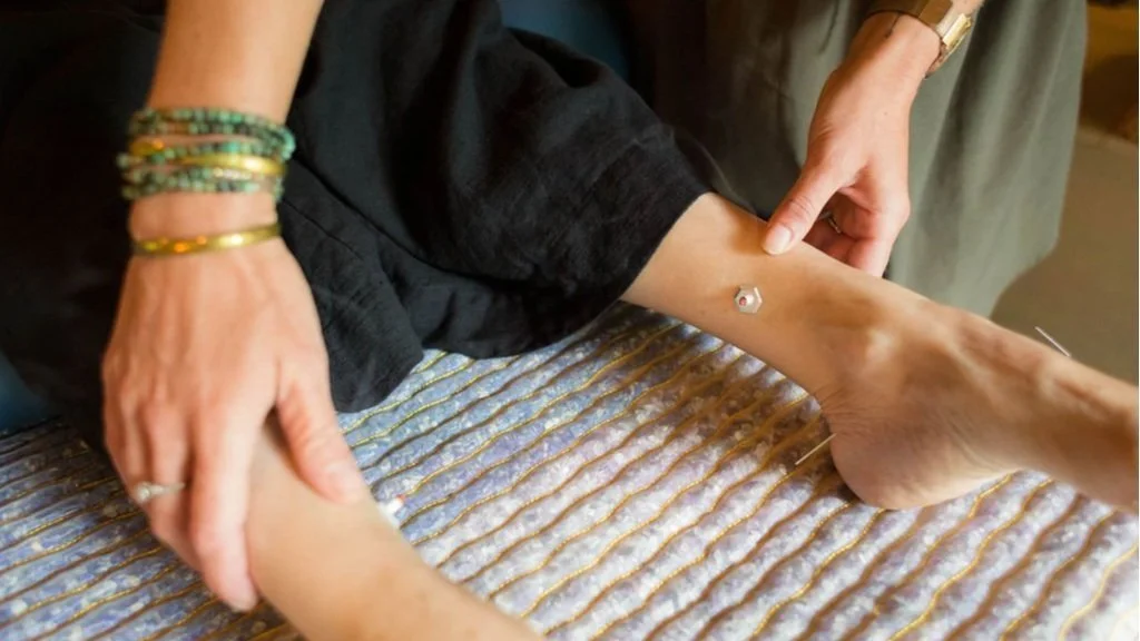 How to Enhance the Healing Benefits of Acupuncture