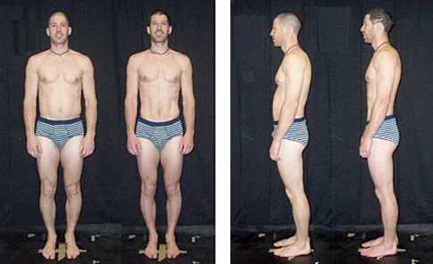 Comparison photos of a shirtless man in striped underwear, showing front and side views before and after Rolfing 10 series changes.