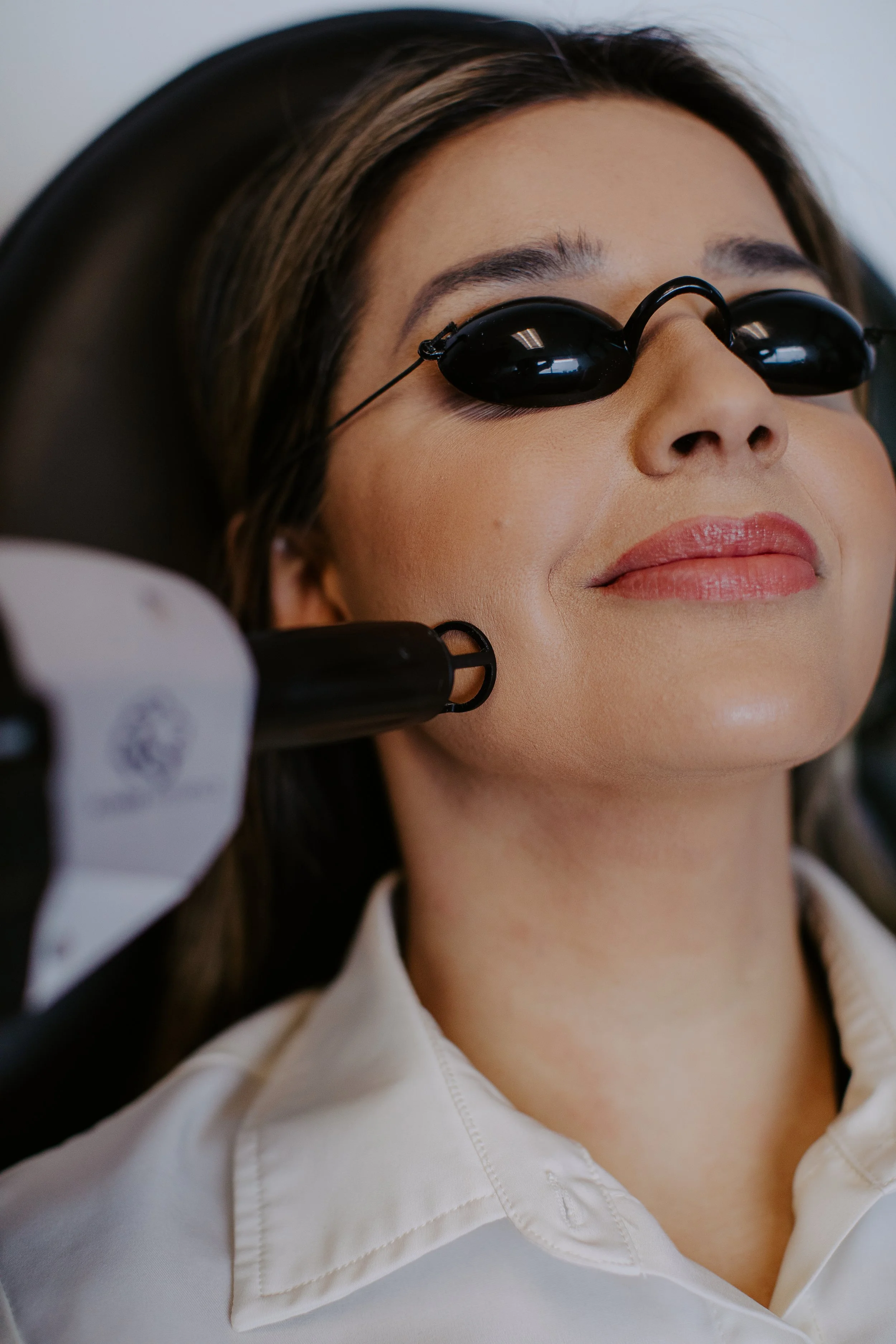 Patient wearing protective eye shields during a facial laser treatment at Sona Medical Aesthetics Newcastle WA