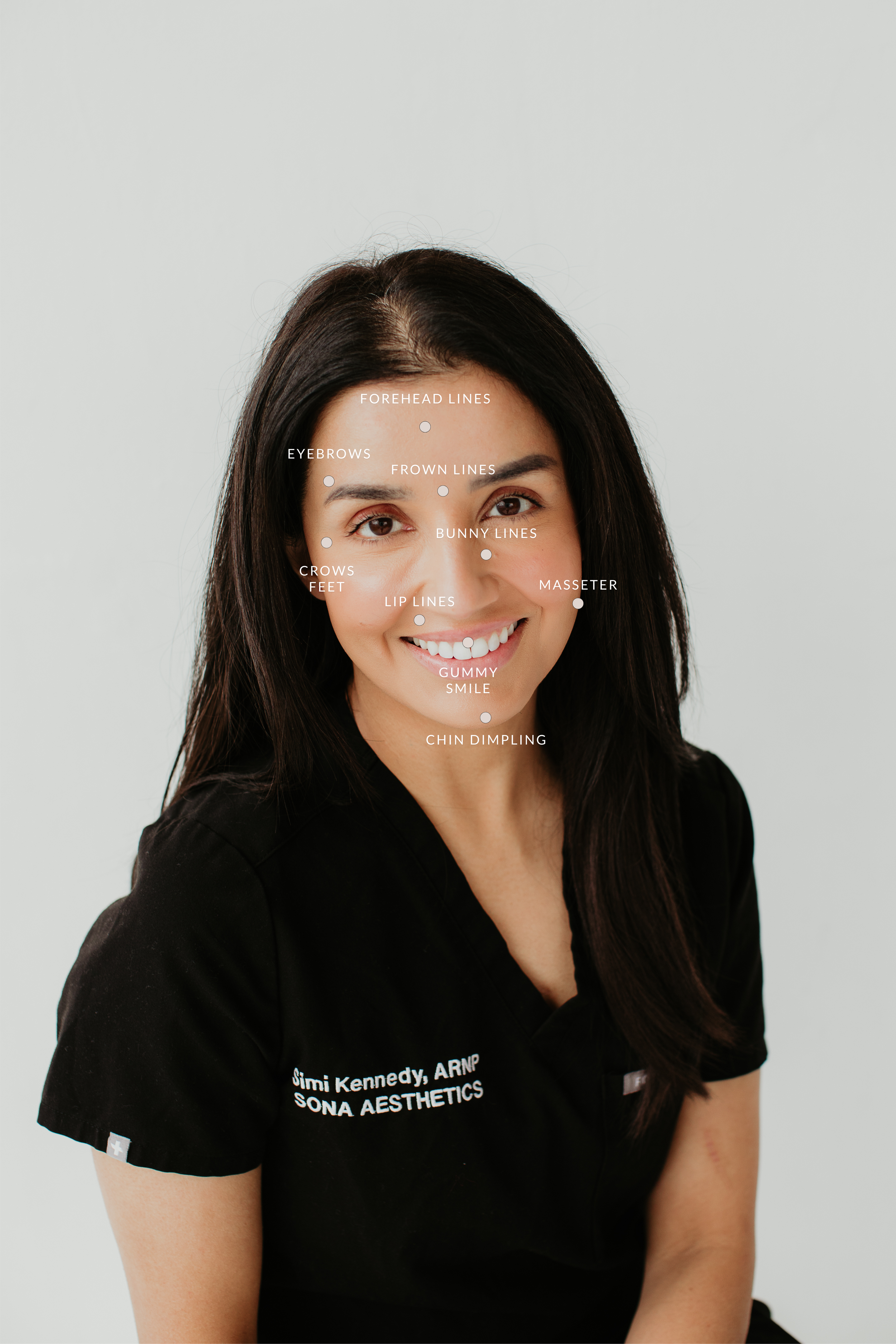 Wrinkle relaxer injectable treatment areas diagram — Sona Medical Aesthetics Newcastle WA