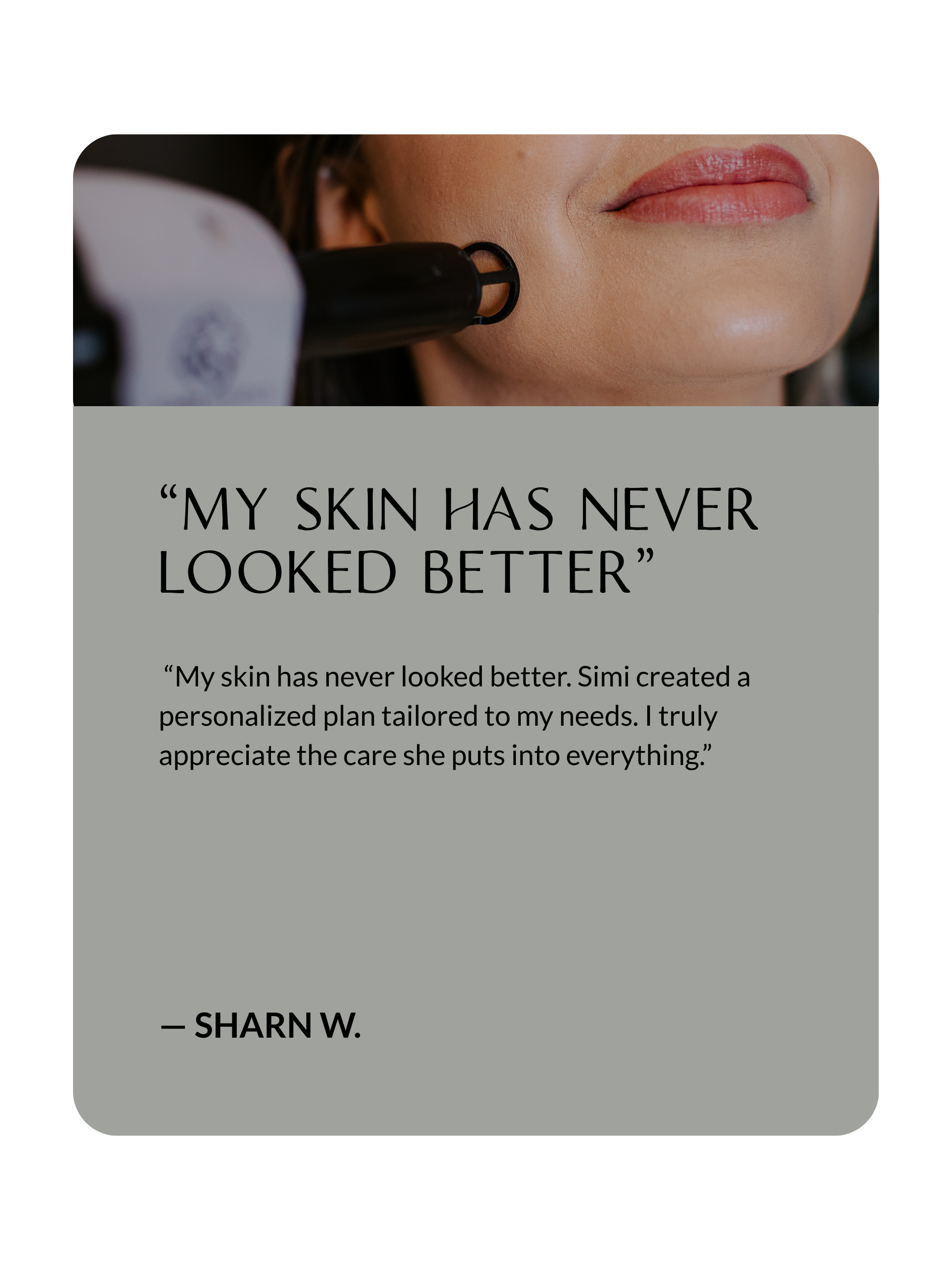 Client testimonial about laser sun damage correction at Sona Medical Aesthetics Newcastle WA