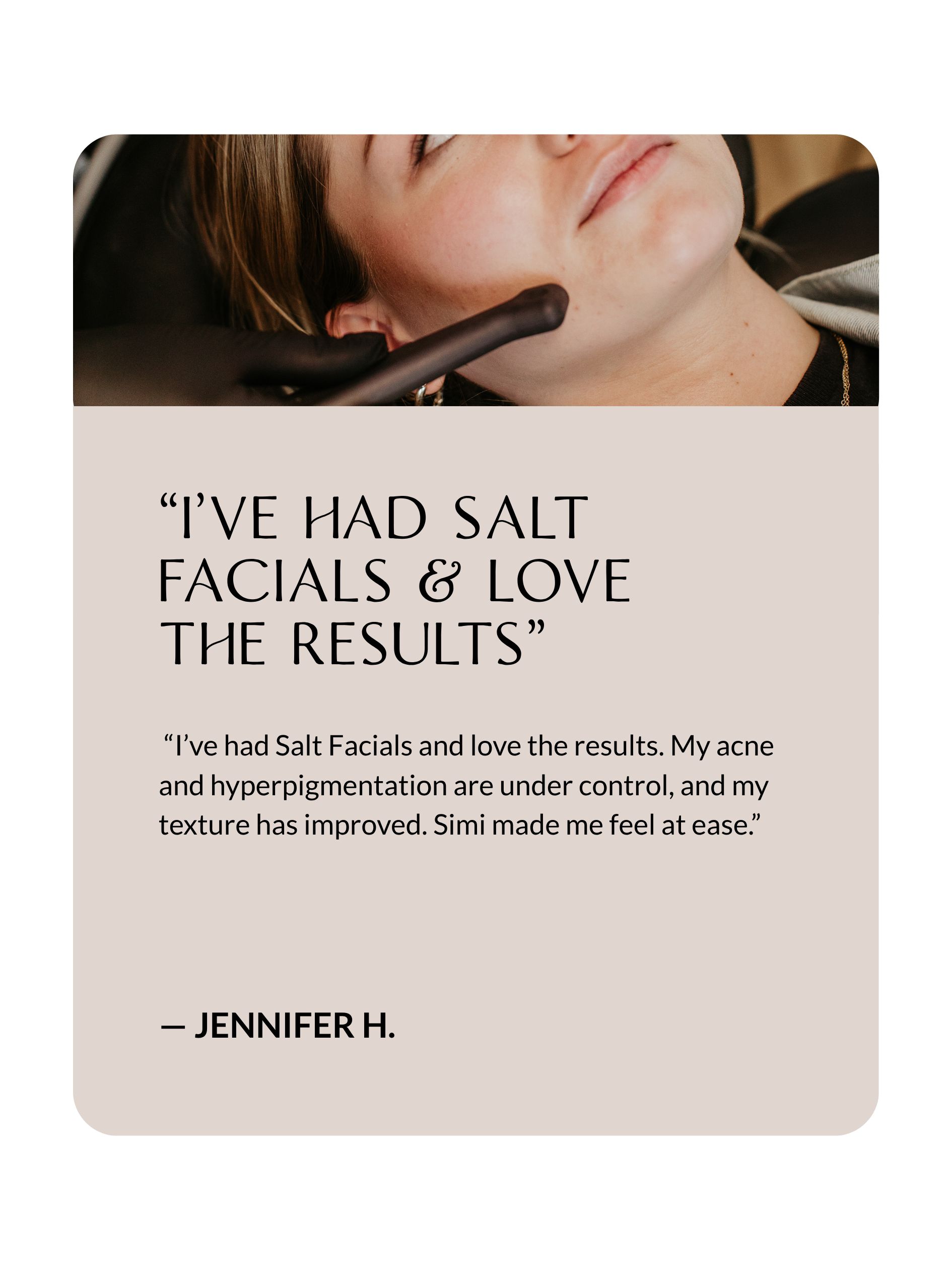 Client testimonial about acne and breakout treatment at Sona Medical Aesthetics Newcastle WA