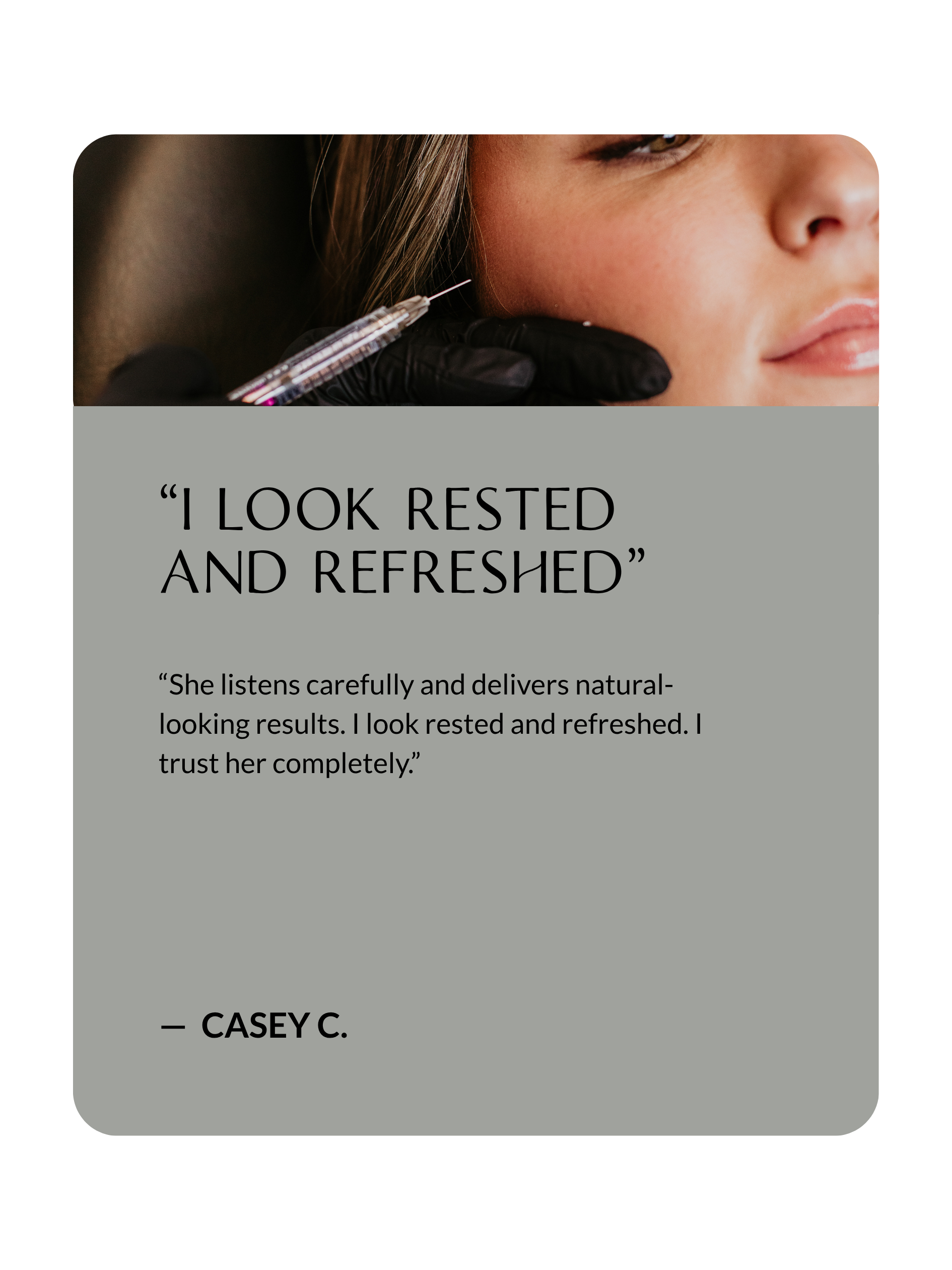 Client testimonial about dermal filler volume restoration at Sona Medical Aesthetics Newcastle WA