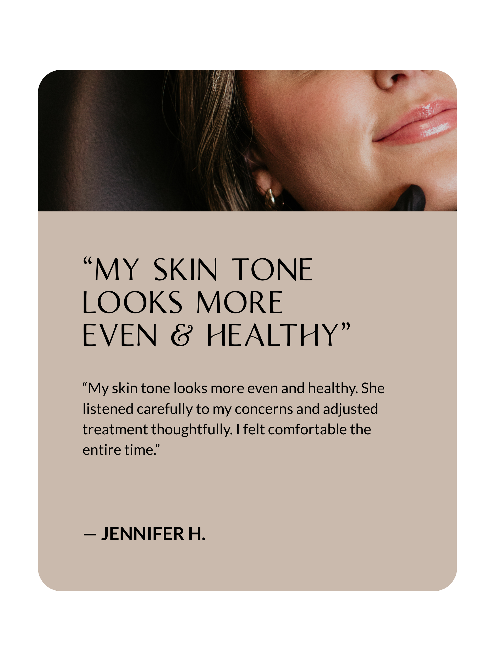 Client testimonial about rosacea treatment at Sona Medical Aesthetics Newcastle WA