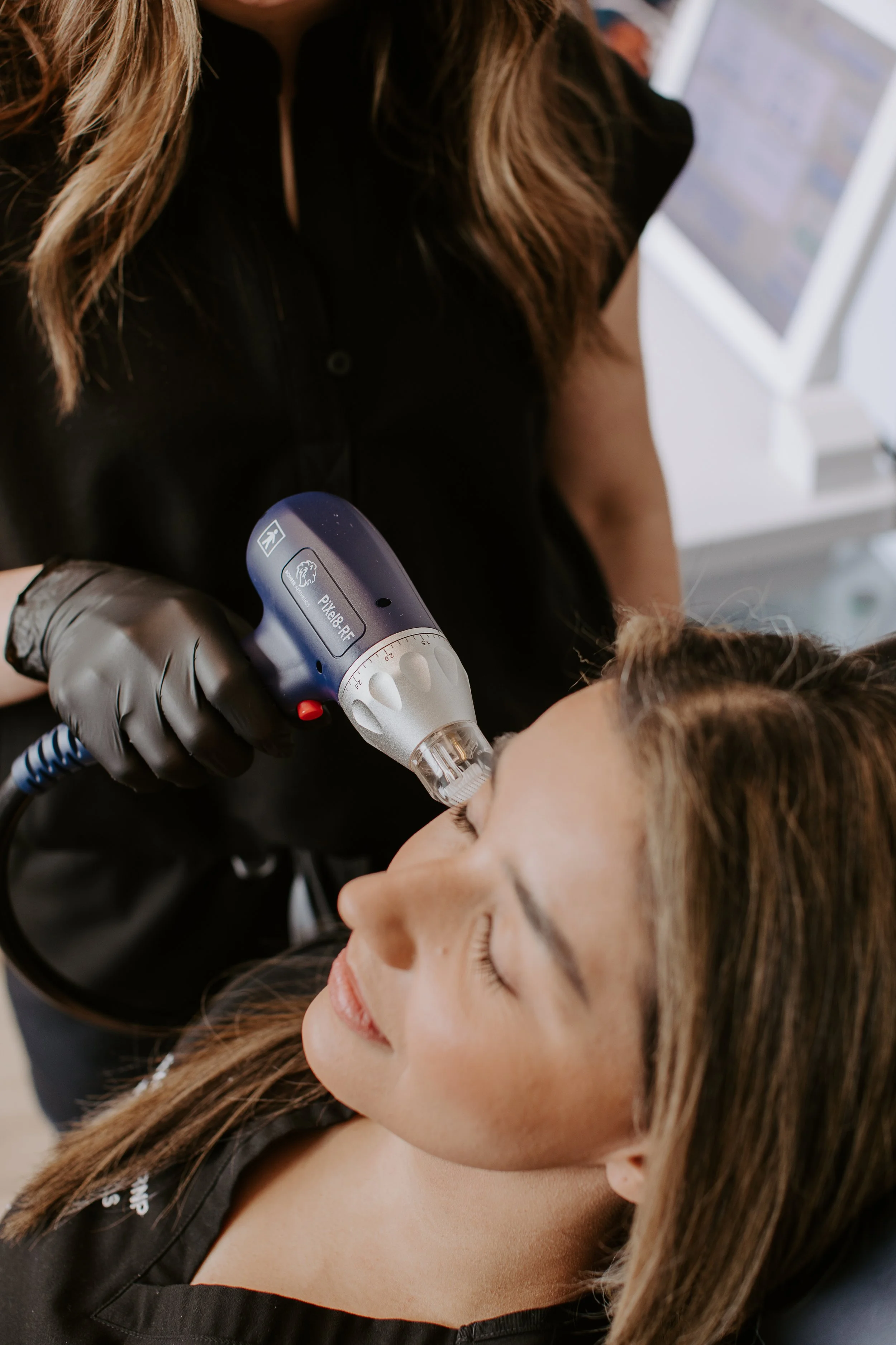 Gloved provider performing PiXel8-RF radiofrequency microneedling treatment on a patient's cheek at Sona Medical Aesthetics Newcastle WA