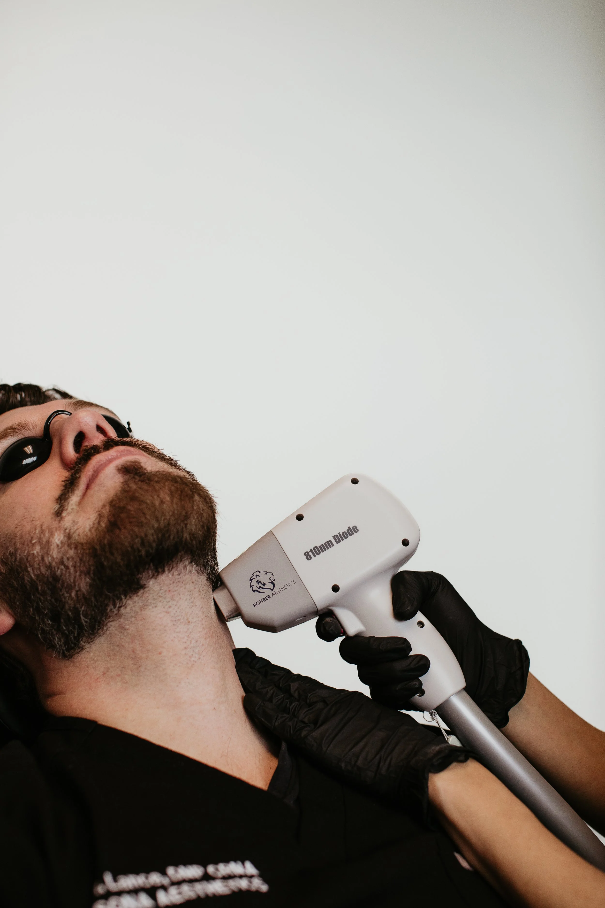 Gloved provider performing Rohrer Aesthetics 810nm Diode laser hair removal on a male patient's neck at Sona Medical Aesthetics Newcastle WA