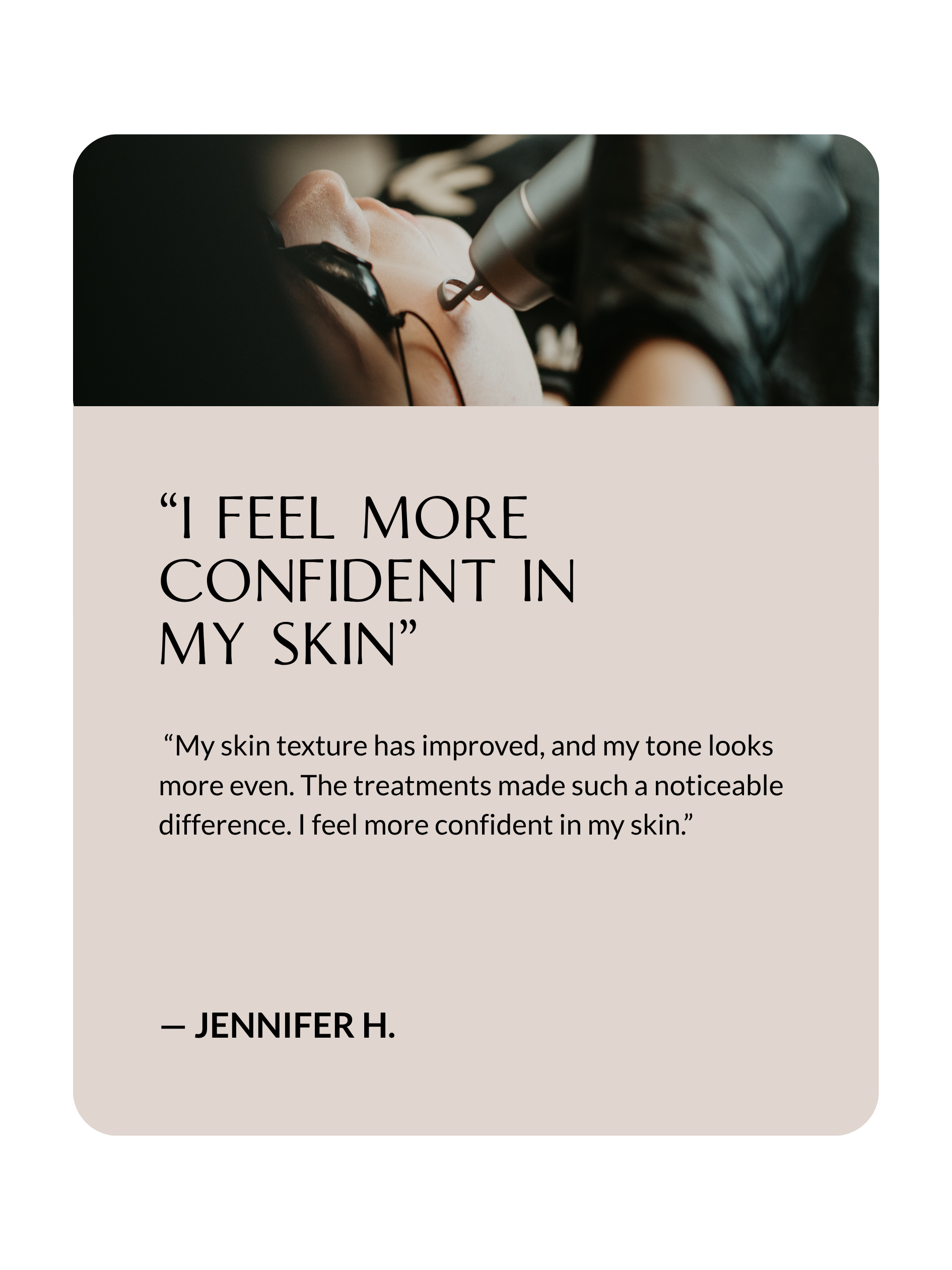 Client testimonial about acne scar treatment results at Sona Medical Aesthetics Newcastle WA