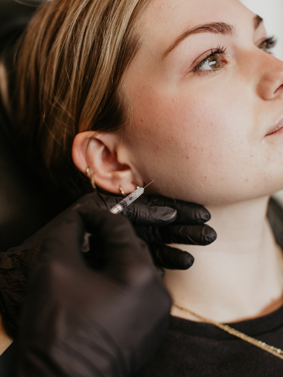 Gloved provider administering Nefertiti neck lift tox treatment for jawline definition at Sona Medical Aesthetics Newcastle WA