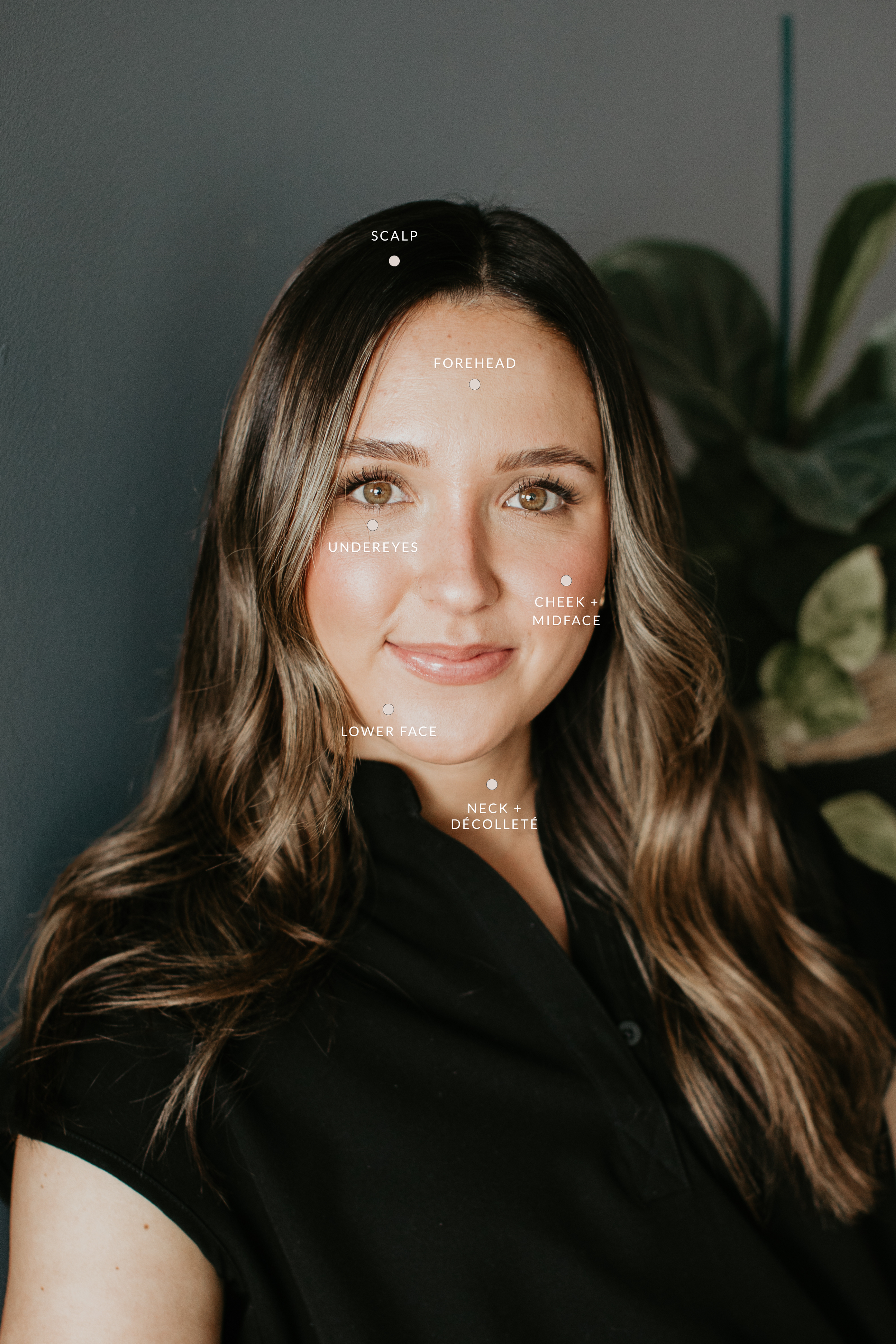 PRP PRF platelet-rich plasma regenerative treatment areas at Sona Medical Aesthetics Newcastle WA