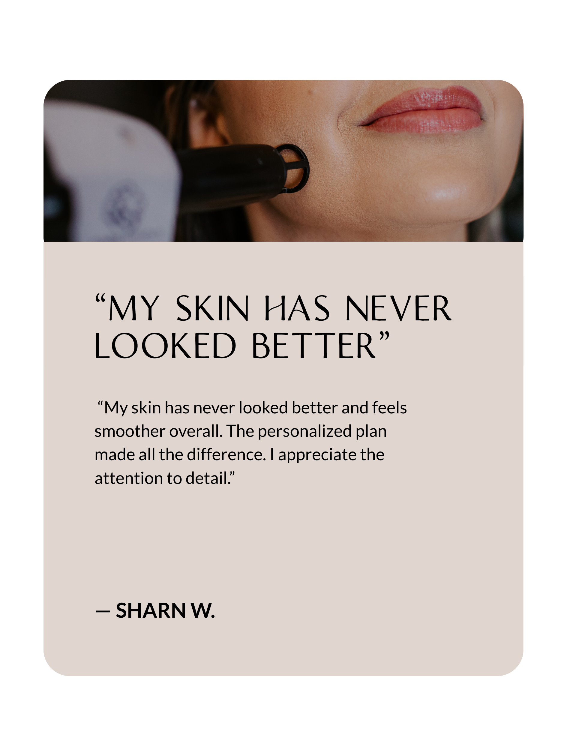 Sona Aesthetics Testimonial from Linda S