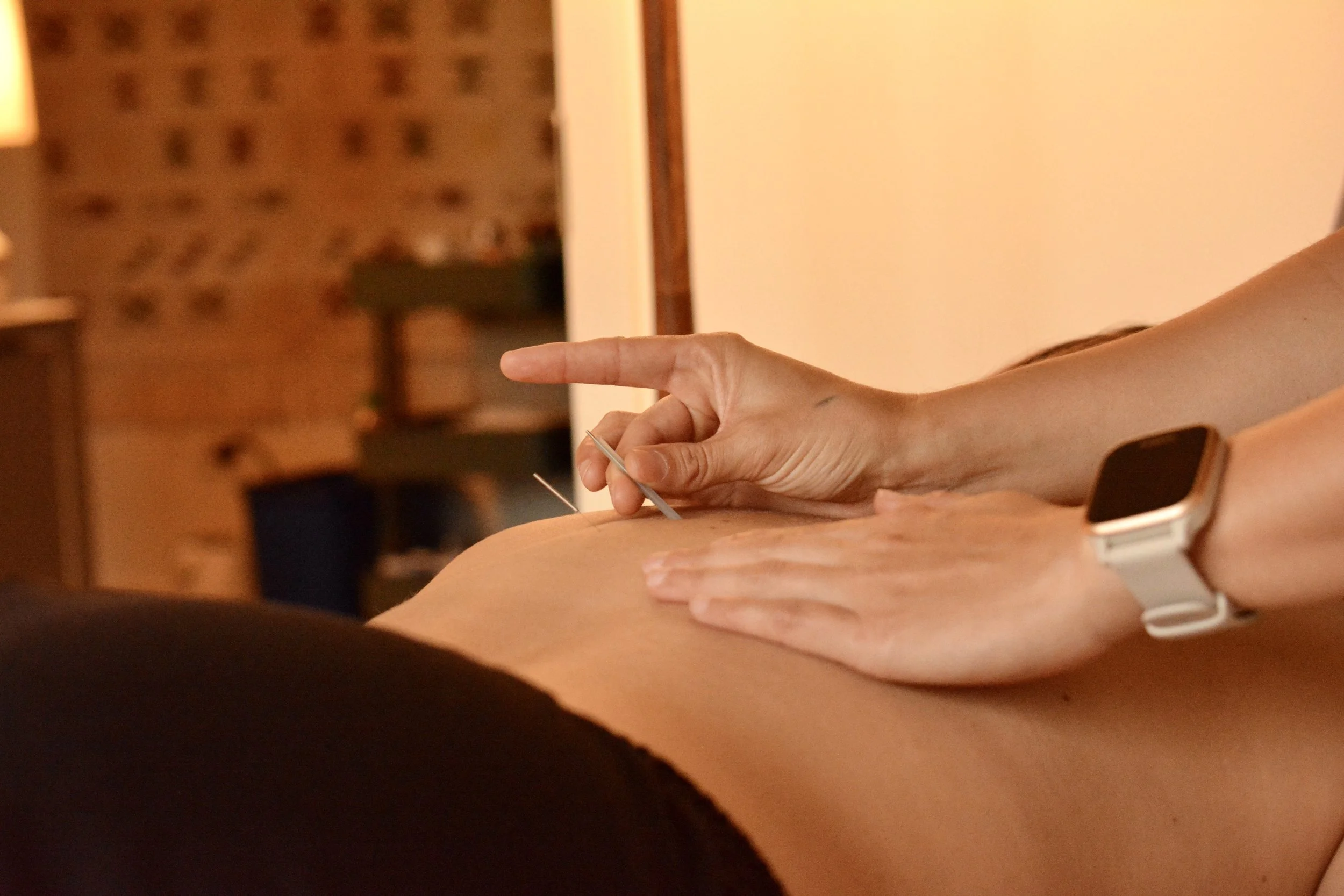What Can Acupuncture Treat?