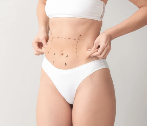 drainage post-opératoire Gentilly