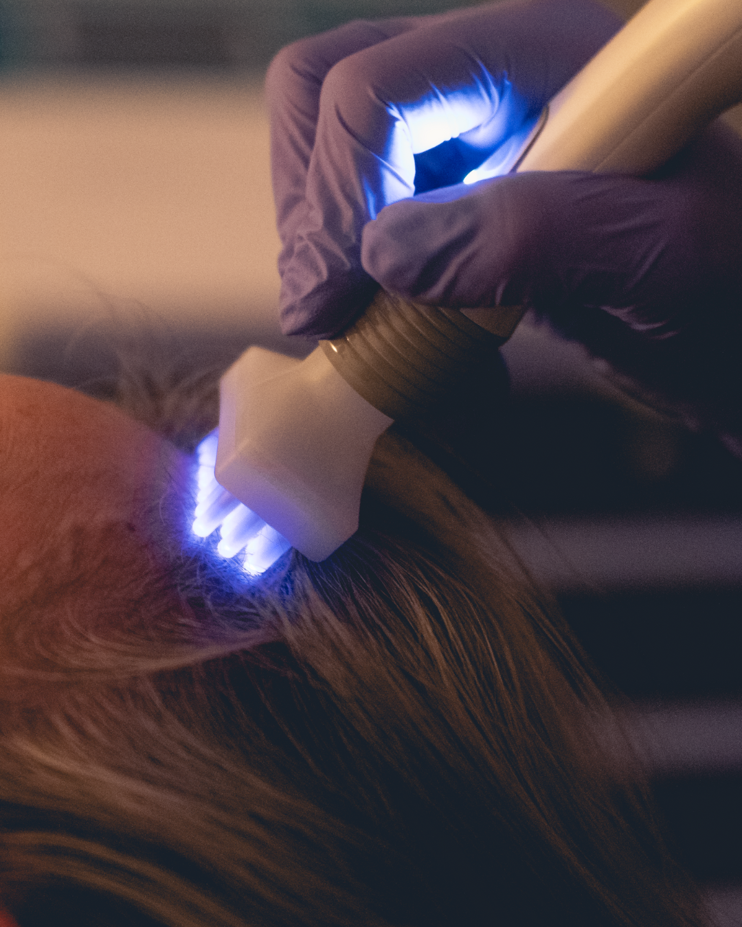 Hair Loss & Thinning Hair Treatments in Arvada, CO | Calm Spirit — Calm ...