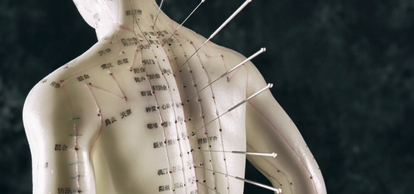 How Massage & Acupuncture Help with Stress, Sleep, & Focus — Calm ...