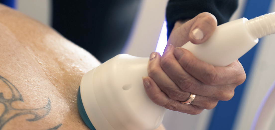 shock wave therapy 