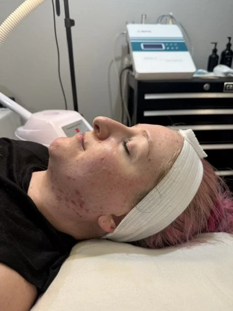 A woman with a cloth headband and pink hair lying on a medical bed, undergoing a skin treatment. Medical equipment and devices are visible in the background.