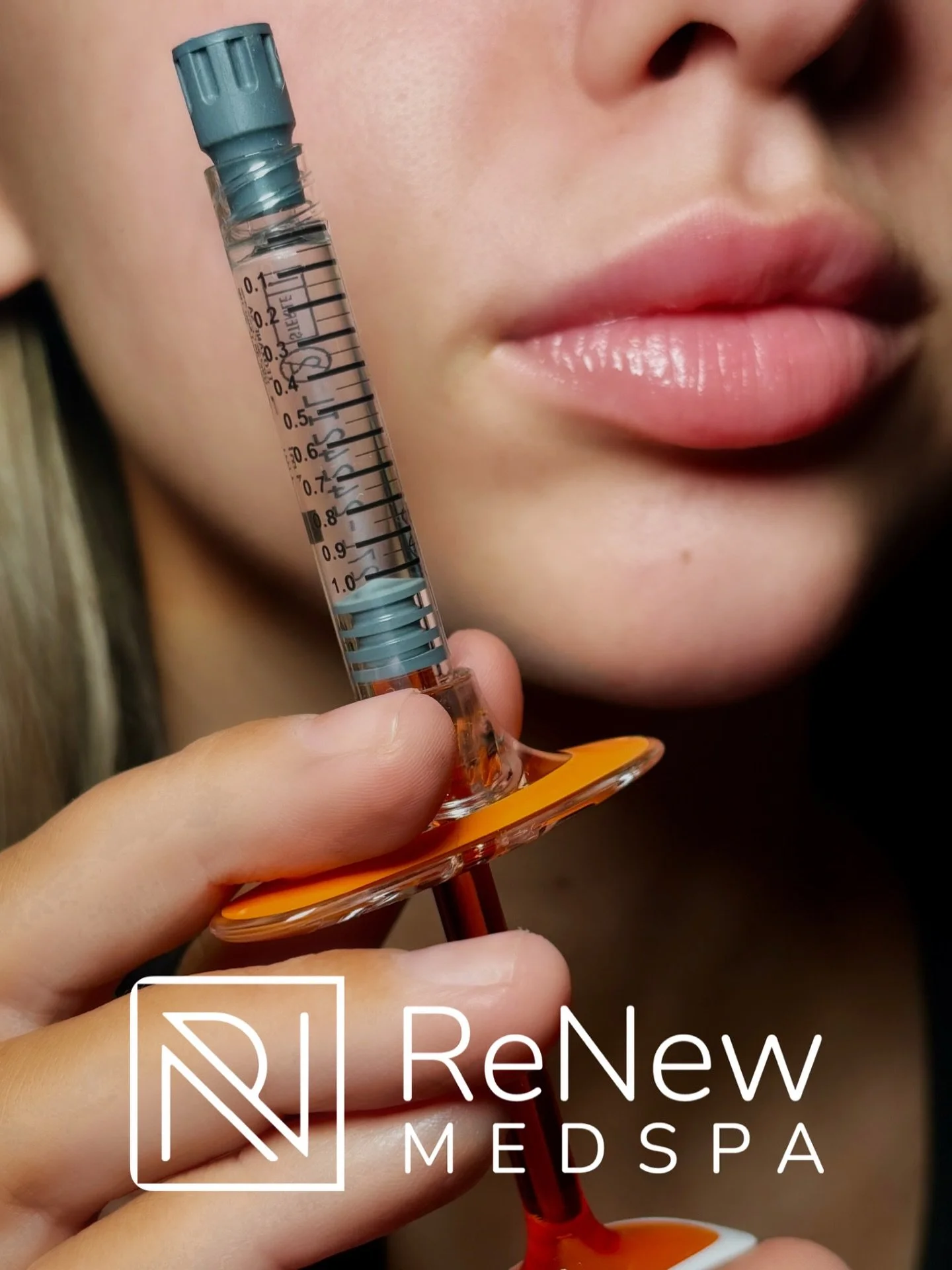 Buy 2 Syringes, Get 2 FREE &mdash; Limited Time! ✨

It&rsquo;s the perfect time to achieve the balance, contour, and glow you&rsquo;ve been dreaming of. Whether you&rsquo;re enhancing lips, defining cheeks, lifting the jawline, or restoring volume lo