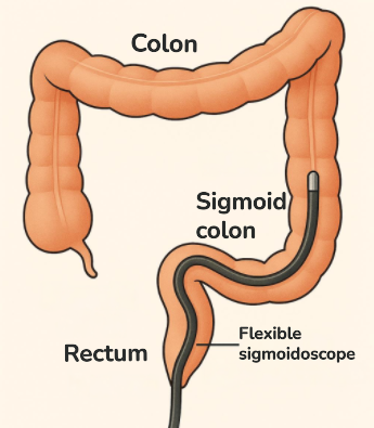 capsule-endoscopy-melbourne-small-bowel-imaging-gsc