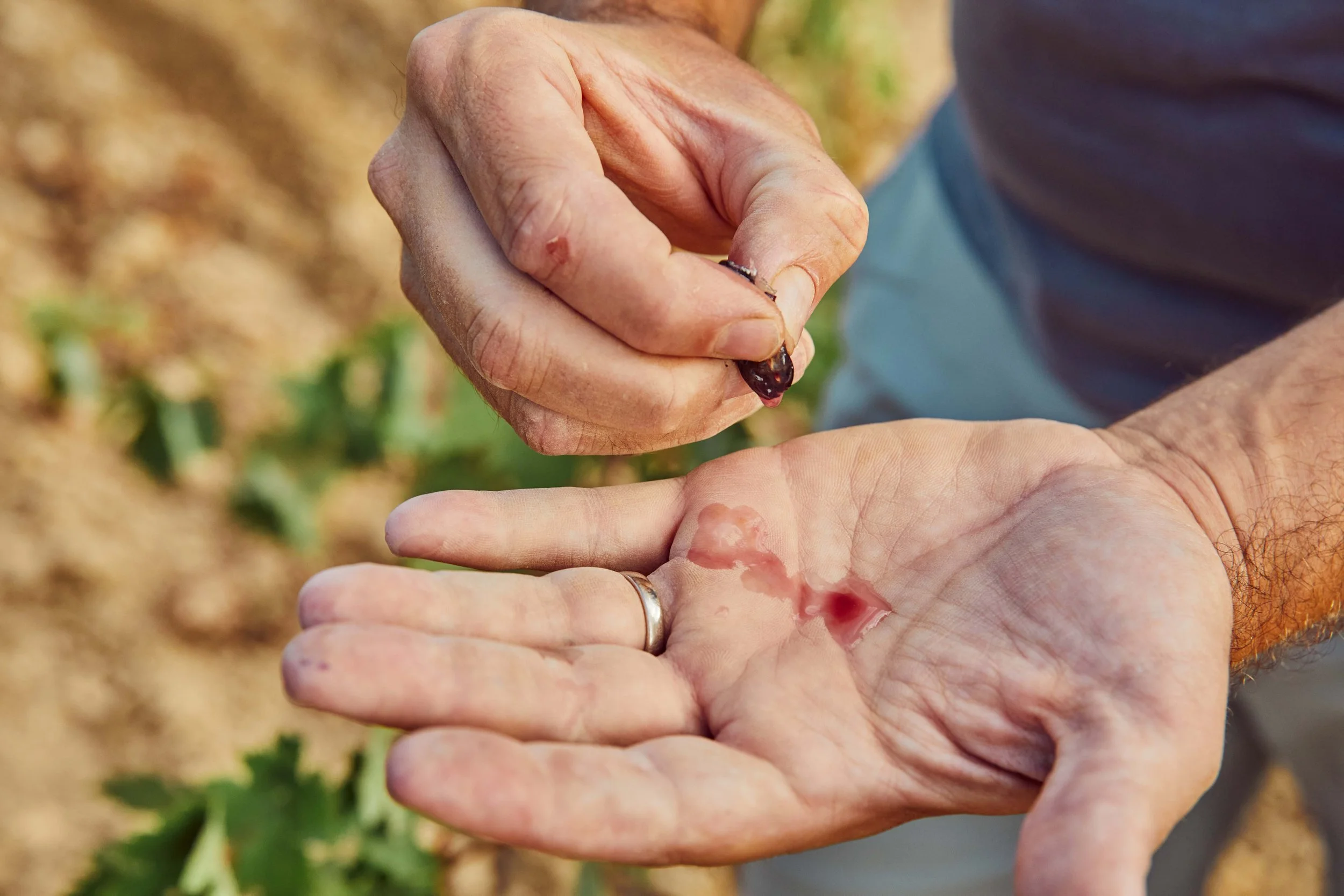 SP-RJ-PR-03_Exopto 75.jpg