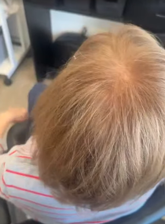 Top view of a person's light brown hair with a natural part.