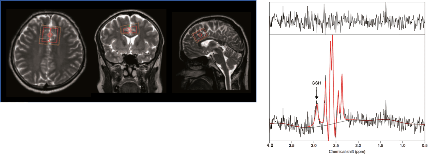 Movement/Exercise Therapy for Schizophrenia