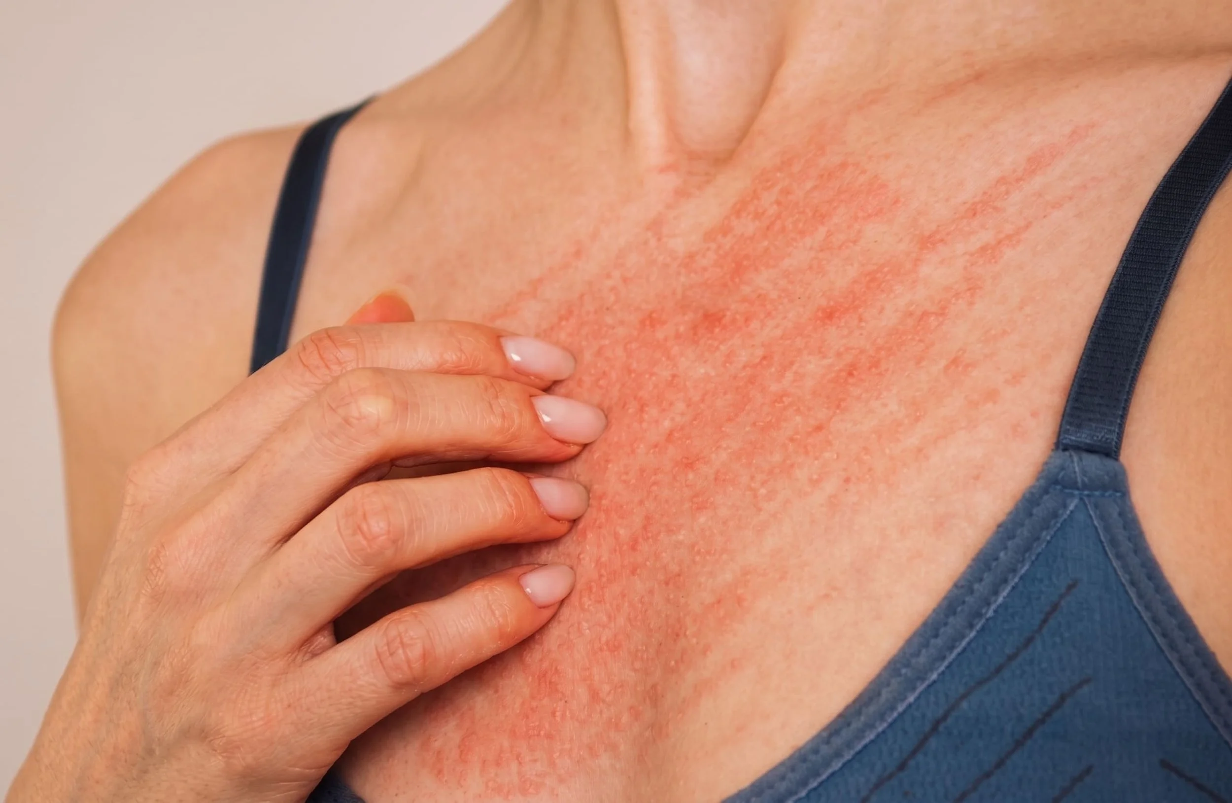 Is Your Diet Fueling Chronic Inflammation? Here's How to Tell