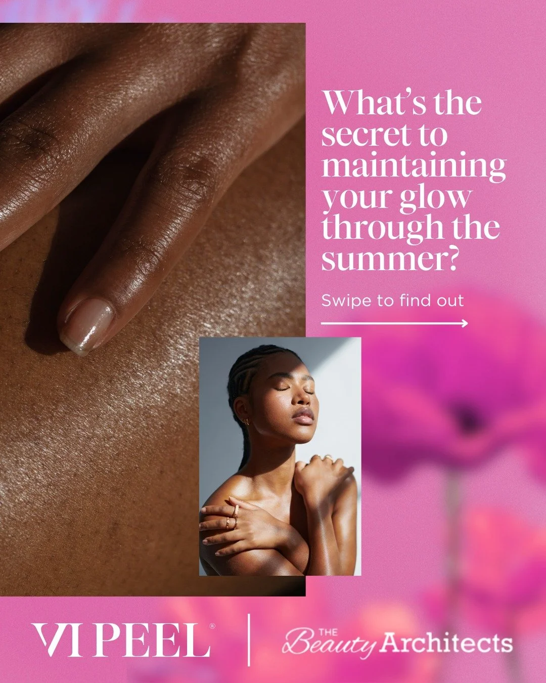 This summer, refresh your skin after every sun-soaked getaway with VI Peel&reg; &mdash;your go-to for controlling melasma and minimizing sun damage. 🌞

Safe and effective all year round, VI Peel&reg; helps you maintain clear, radiant skin no matter 