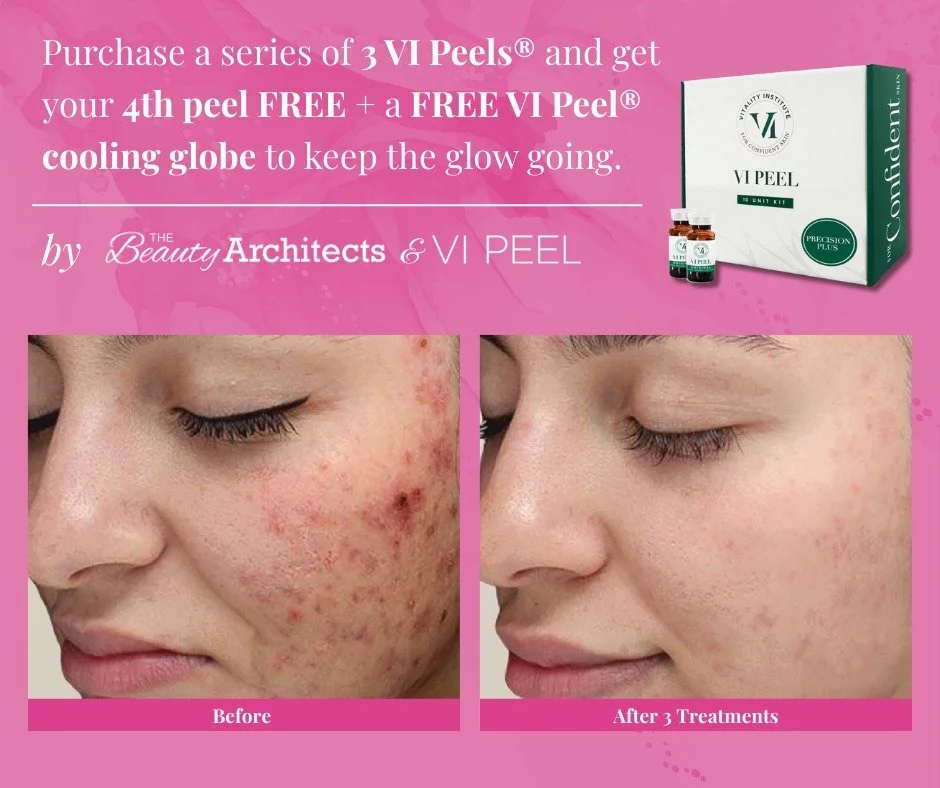 ✨ Glow goals unlocked! ✨

Purchase a series of 3 VI Peels&reg; and get your 4th peel FREE + a FREE VI Peel&reg; cooling globe to keep the glow going.

💬 DM us to find a participating provider... 💬

And don&rsquo;t forget to follow @VIPeel!

#vipeel